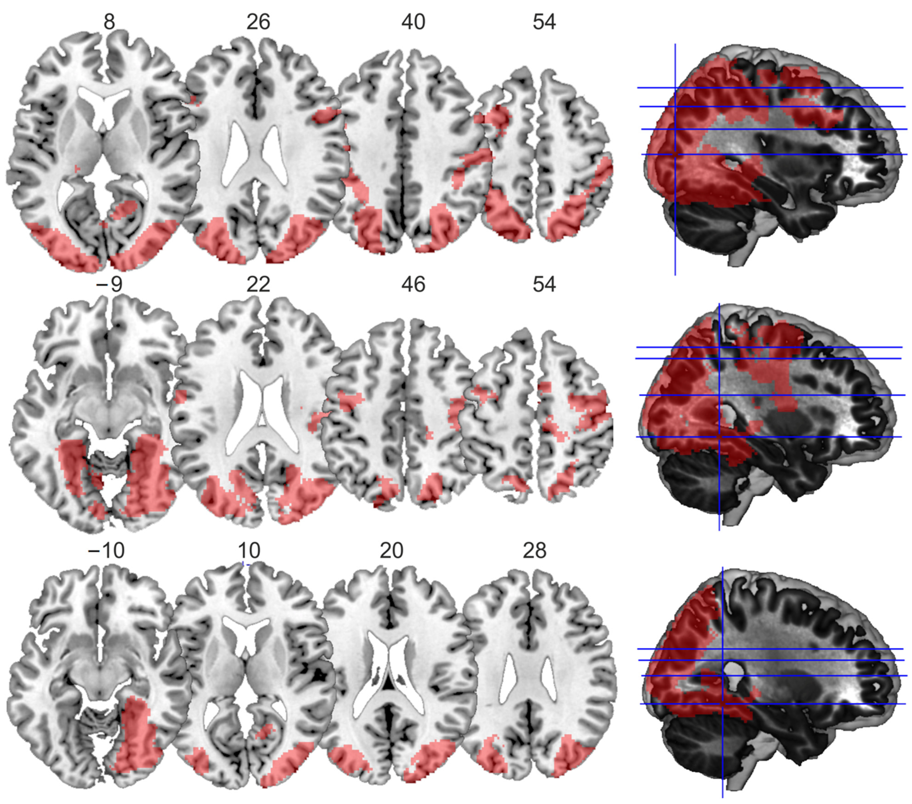 Vision 06 00041 g003 Vision 06 00041 g003