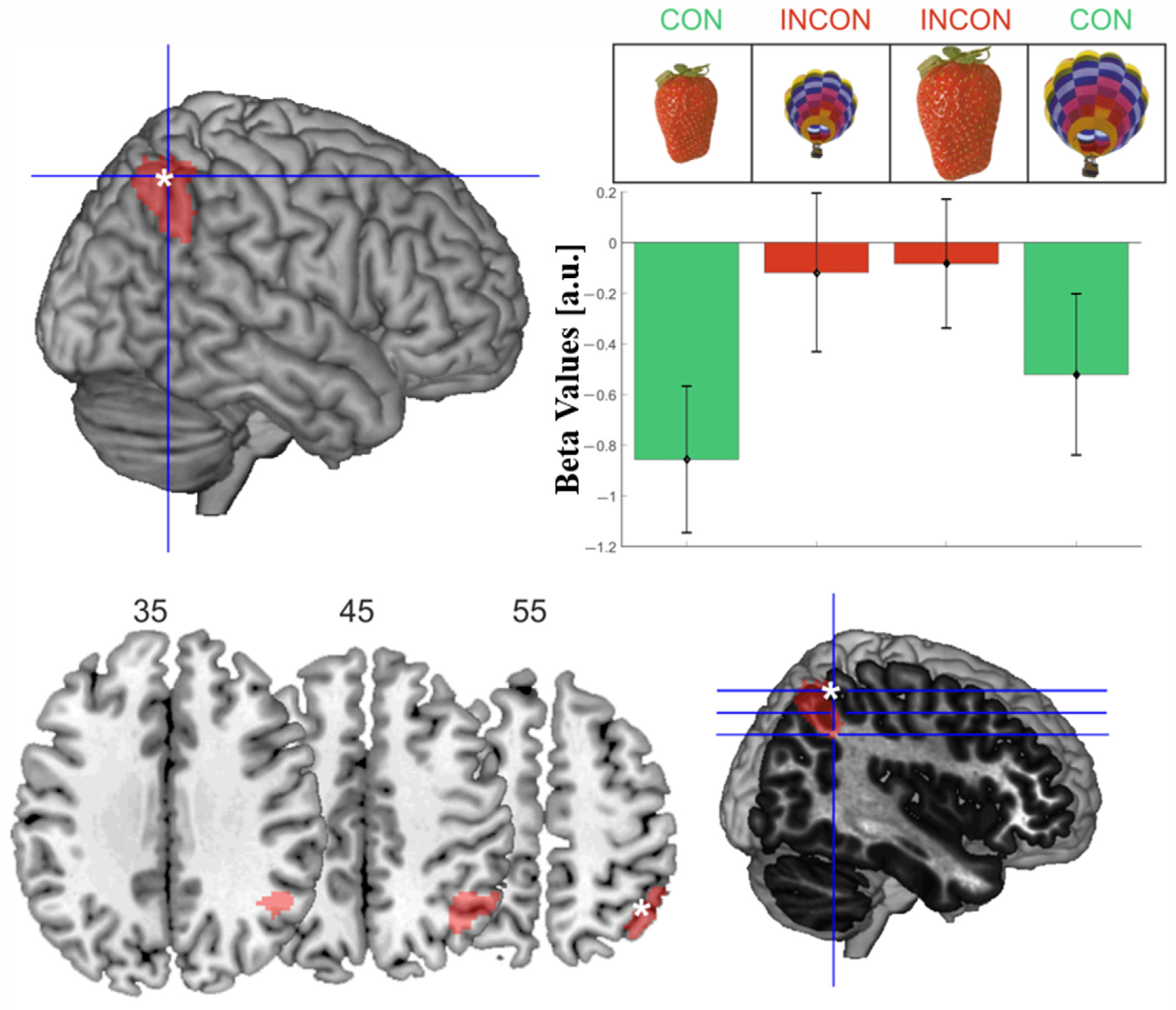 Vision 06 00041 g004 Vision 06 00041 g004