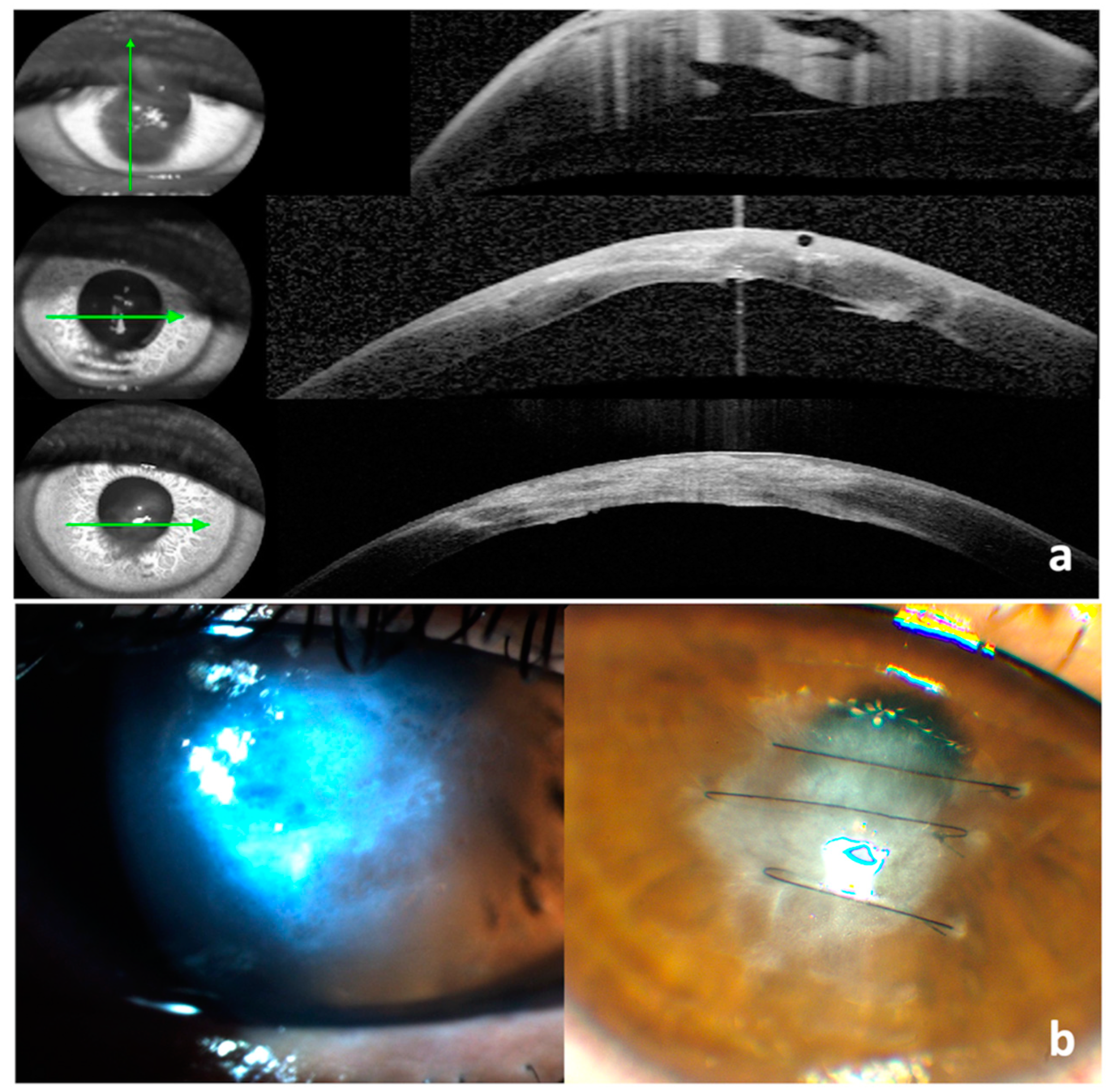 Vision 07 00010 g004