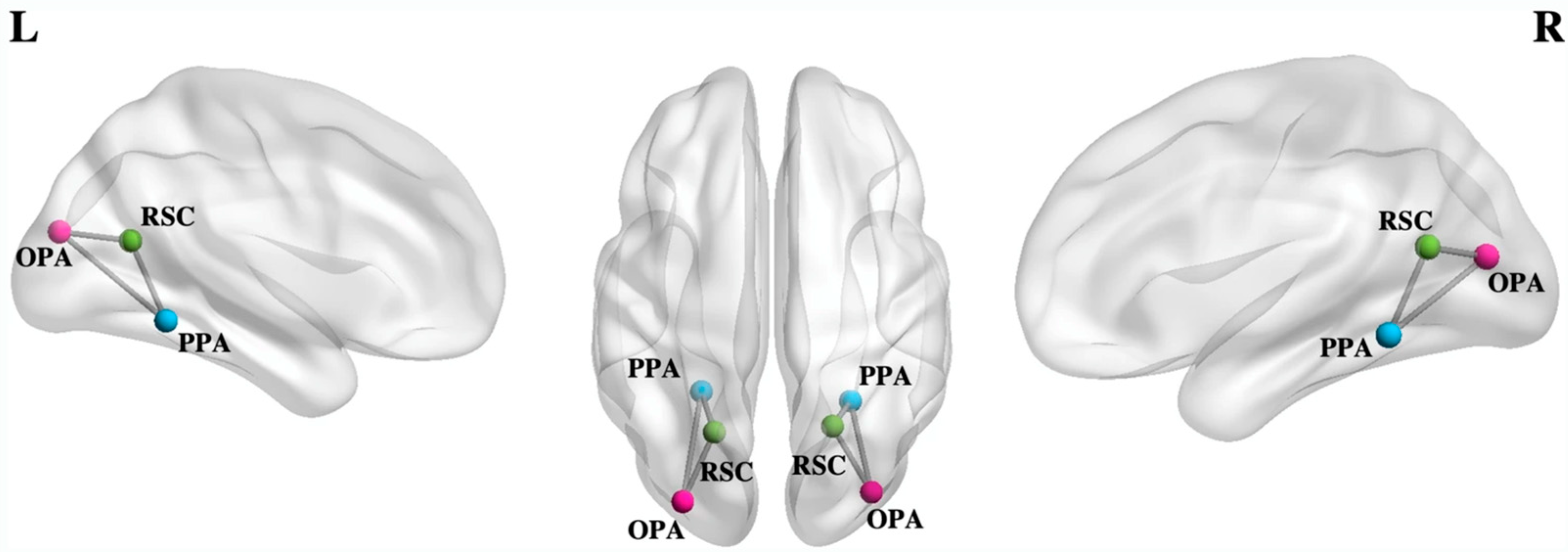 Vision 07 00012 g004