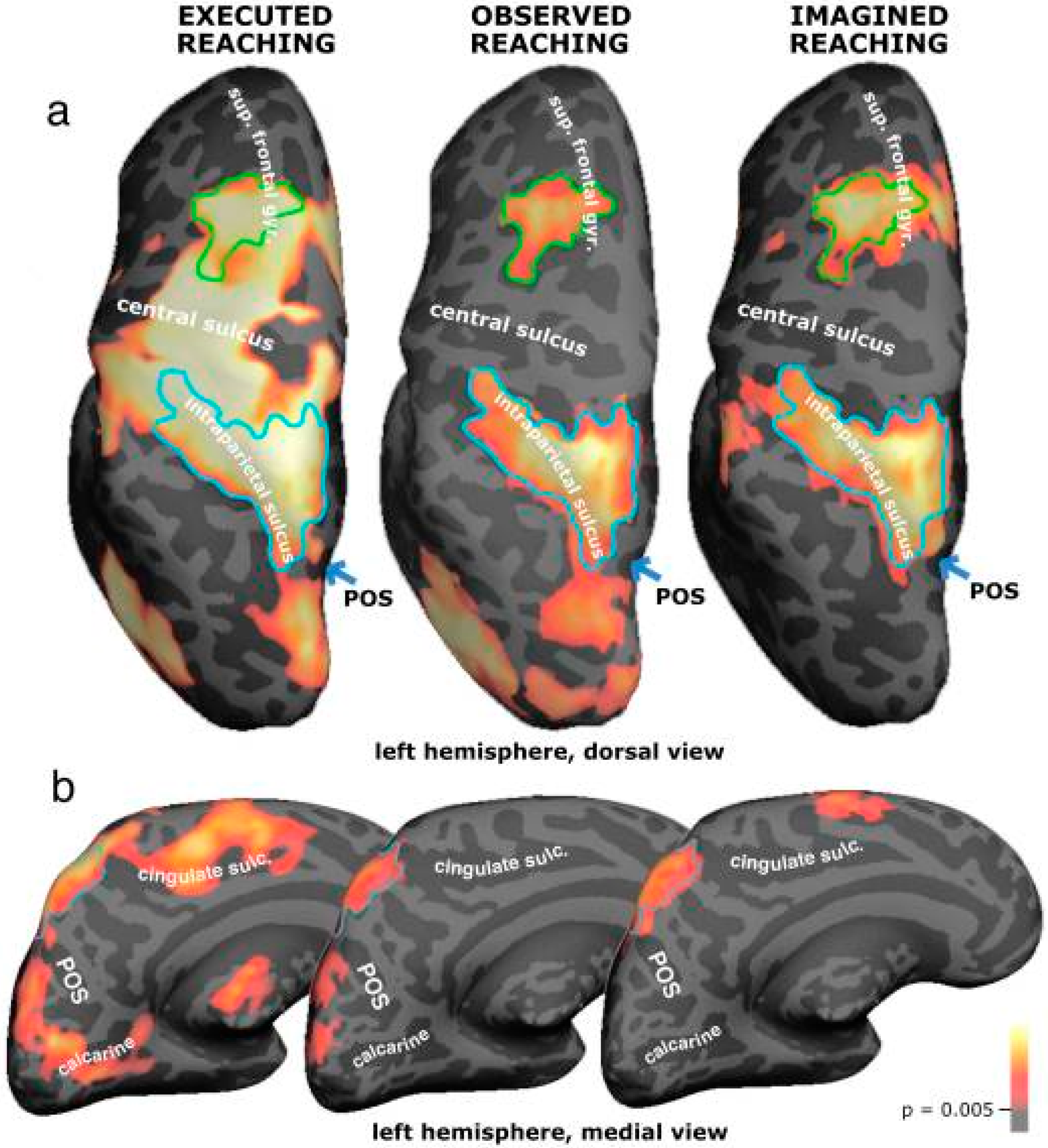 Vision 07 00012 g008