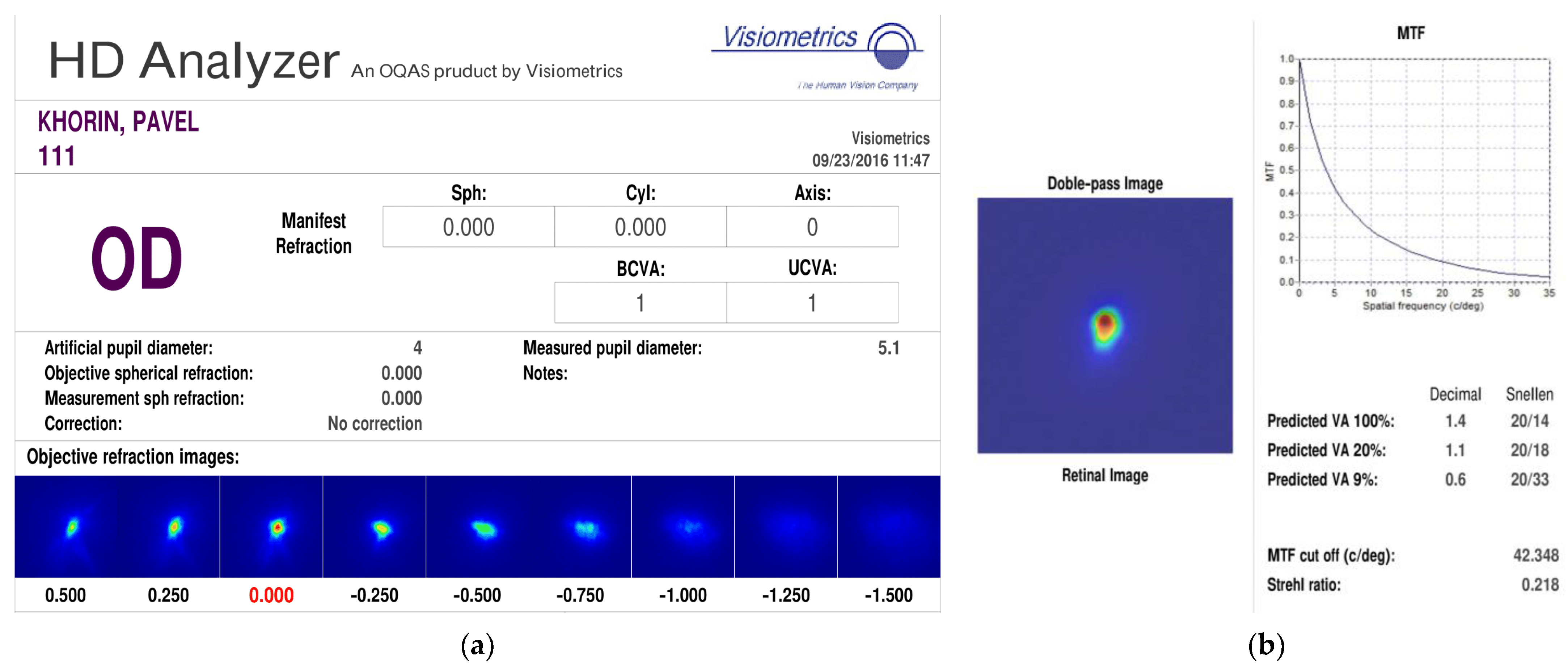 Vision 07 00021 g004a