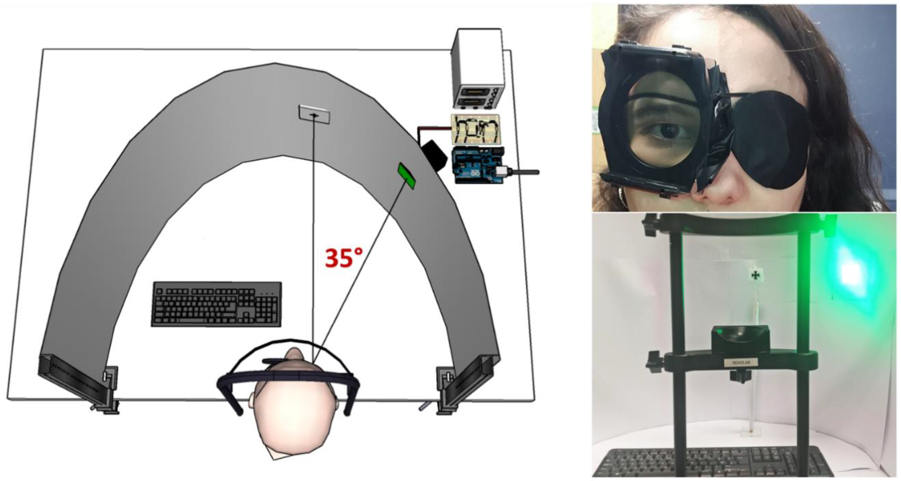 Vision 07 00026 g001 Vision 07 00026 g001