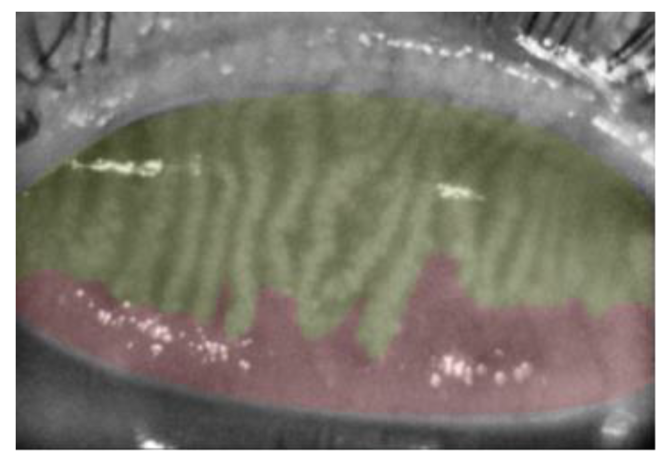 Vision 07 00028 g001 Vision 07 00028 g001