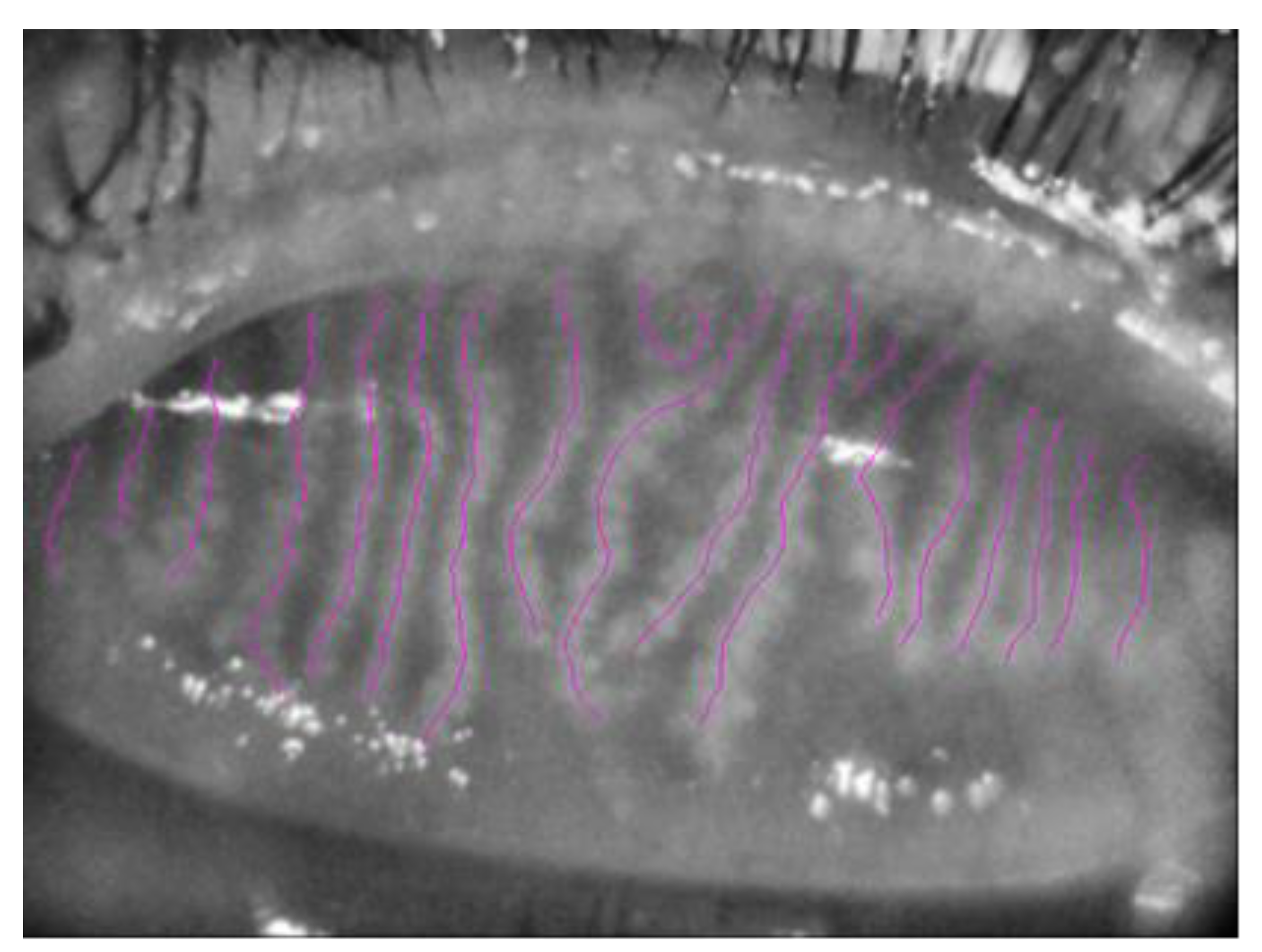 Vision 07 00028 g002 Vision 07 00028 g002