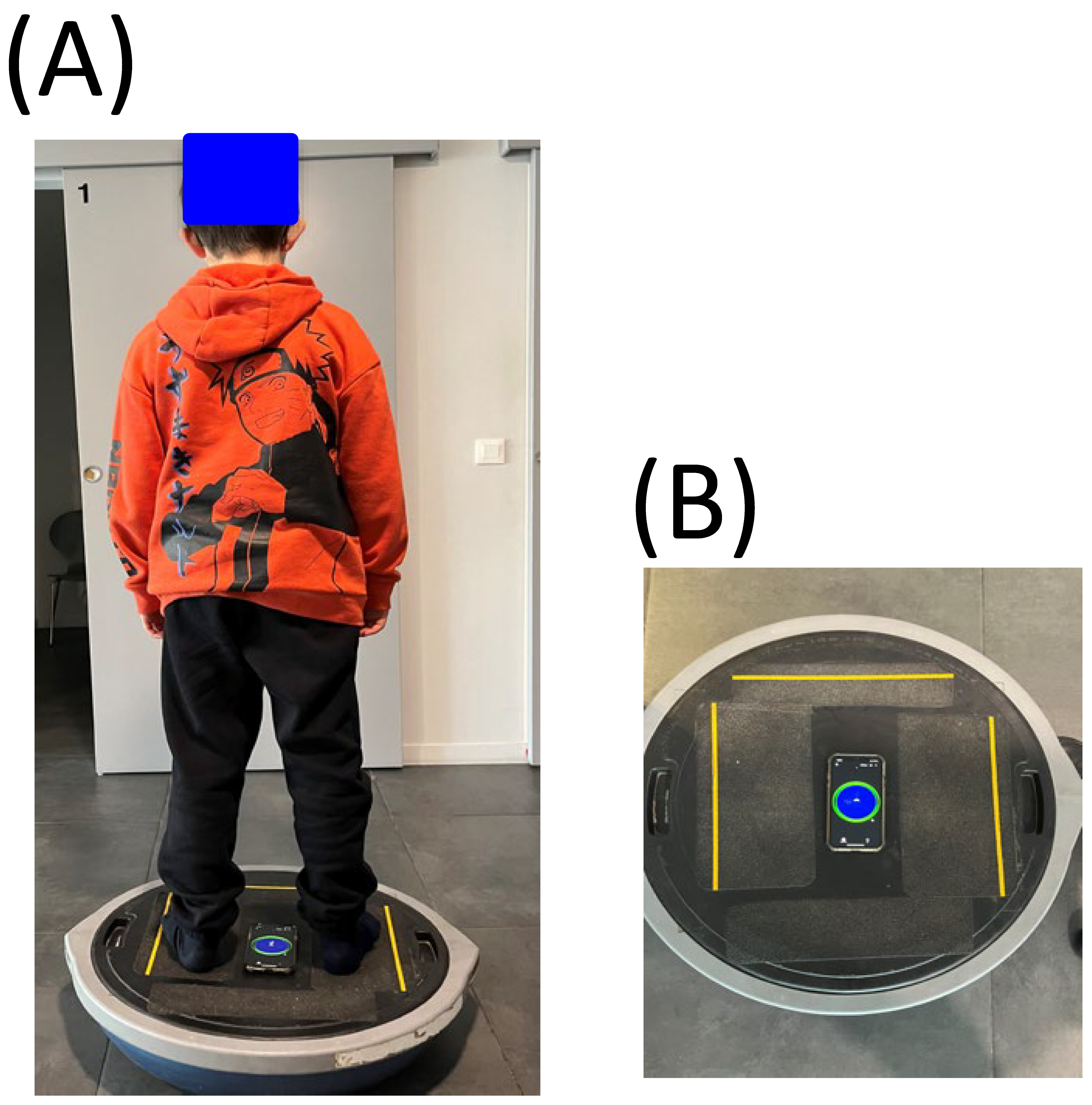 Vision 07 00037 g001 Vision 07 00037 g001