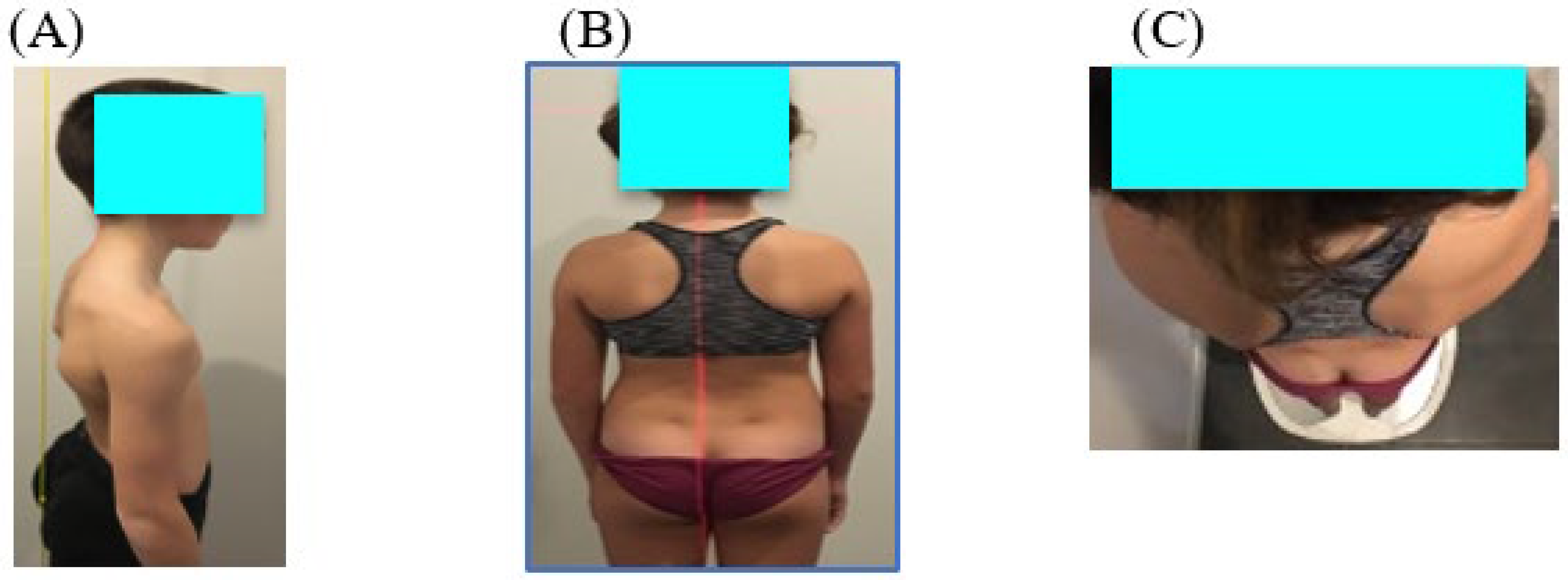 Vision 07 00037 g002 Vision 07 00037 g002