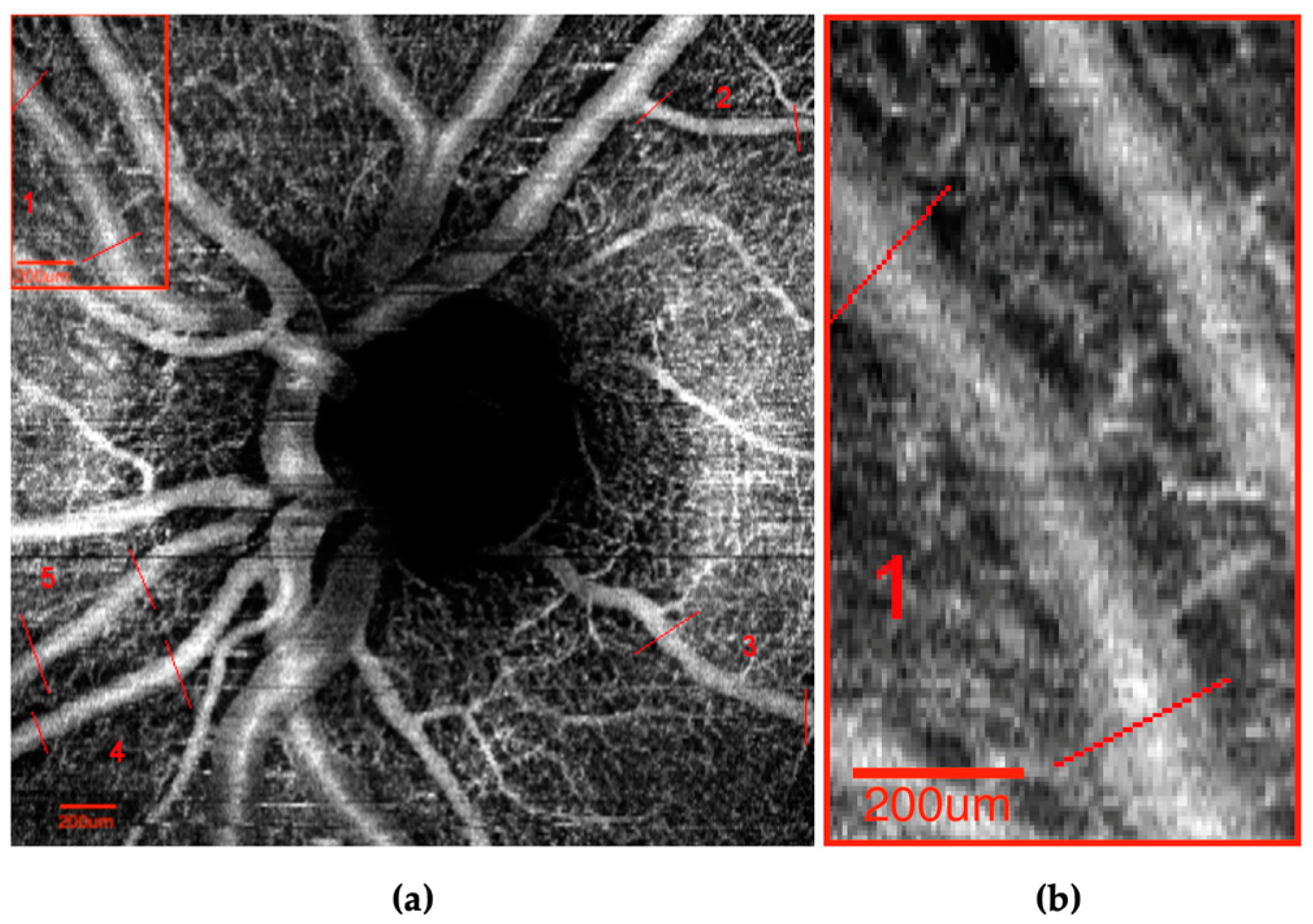 Vision 07 00048 g002
