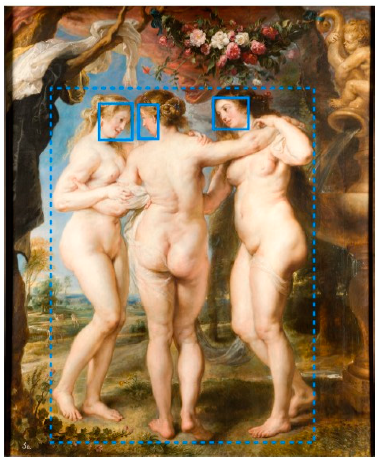 Vision 07 00055 g001 Vision 07 00055 g001