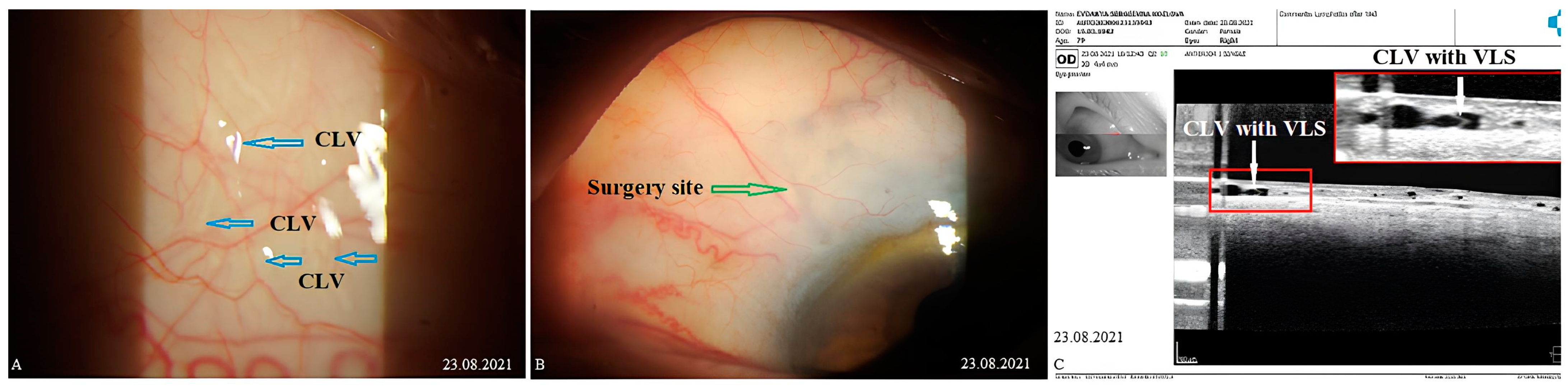 Vision 07 00059 g012