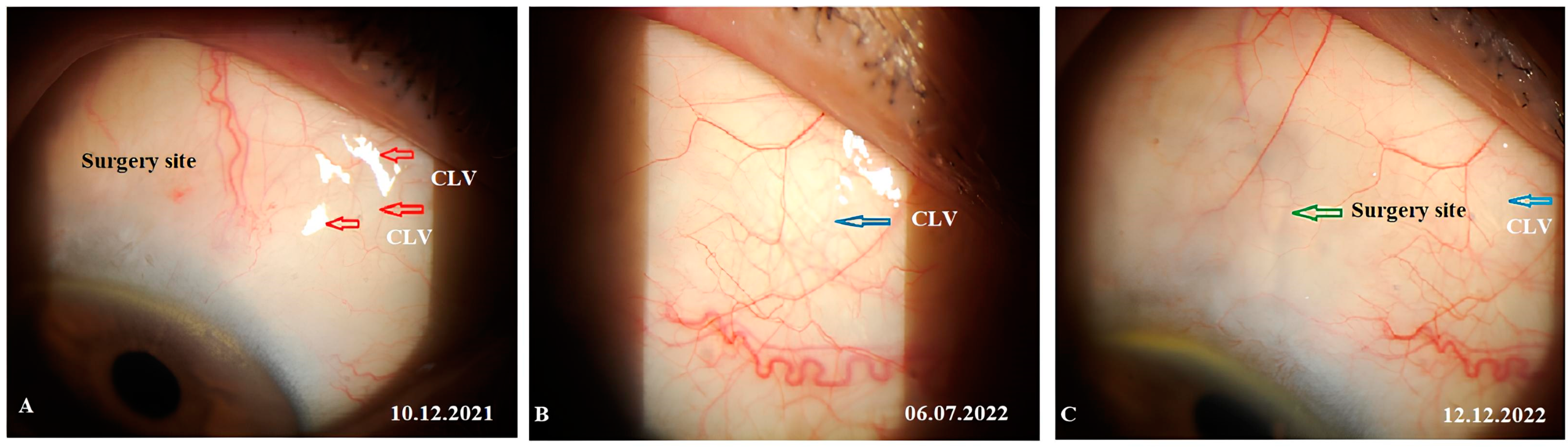 Vision 07 00059 g016