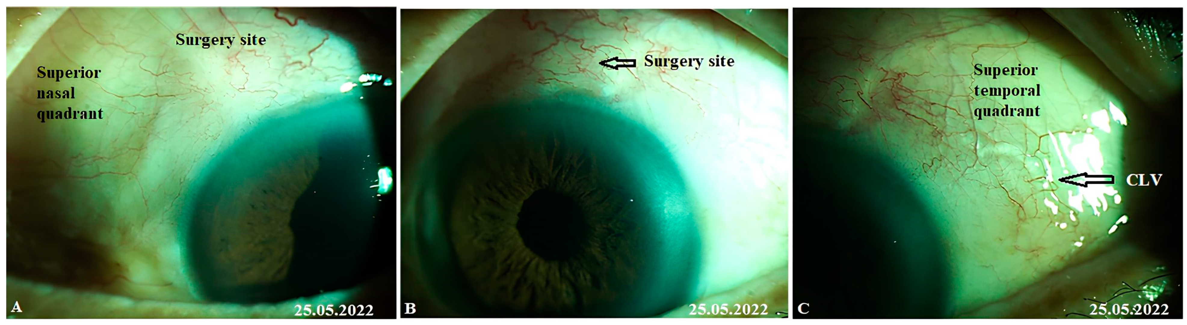 Vision 07 00059 g018