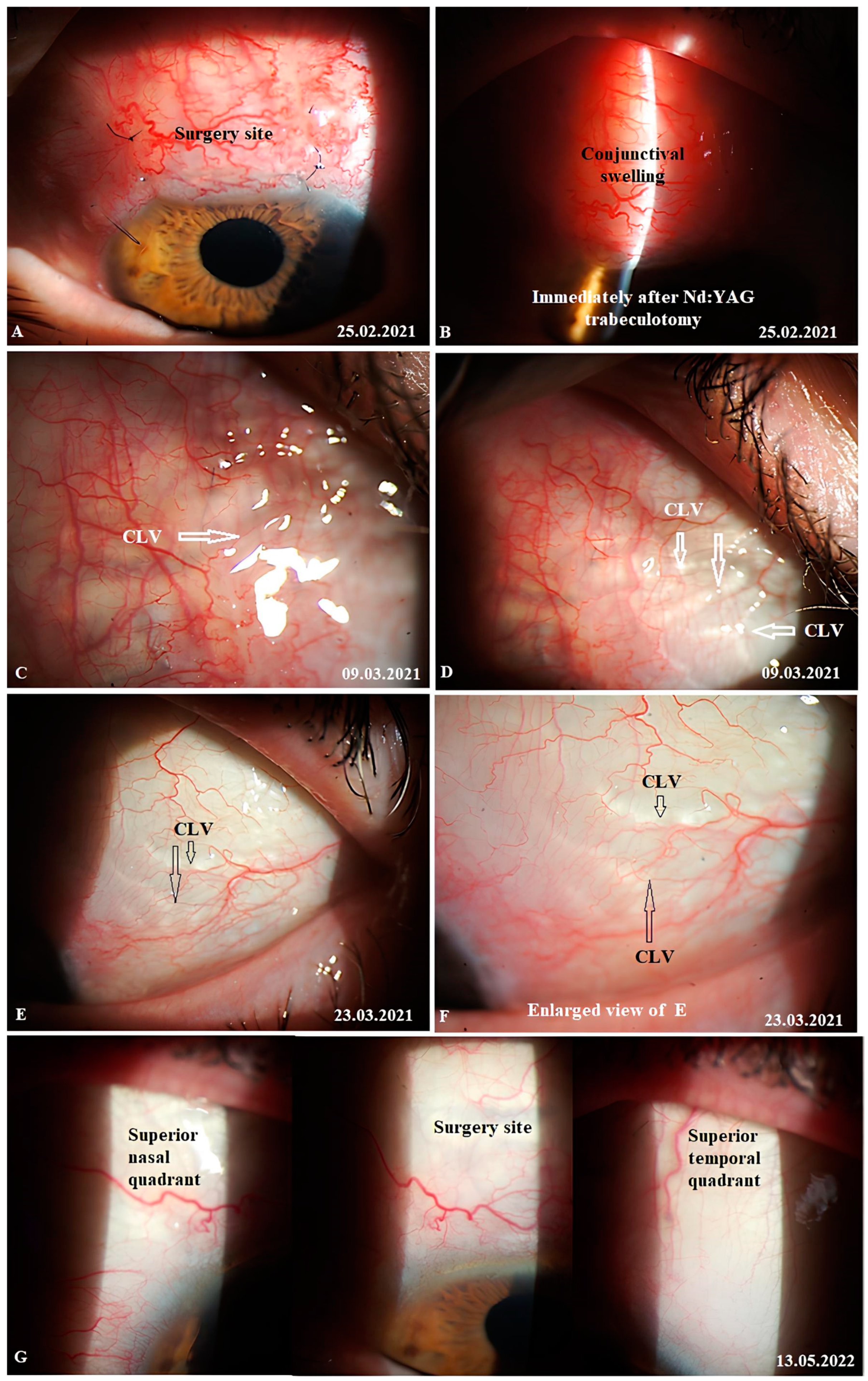 Vision 07 00059 g021