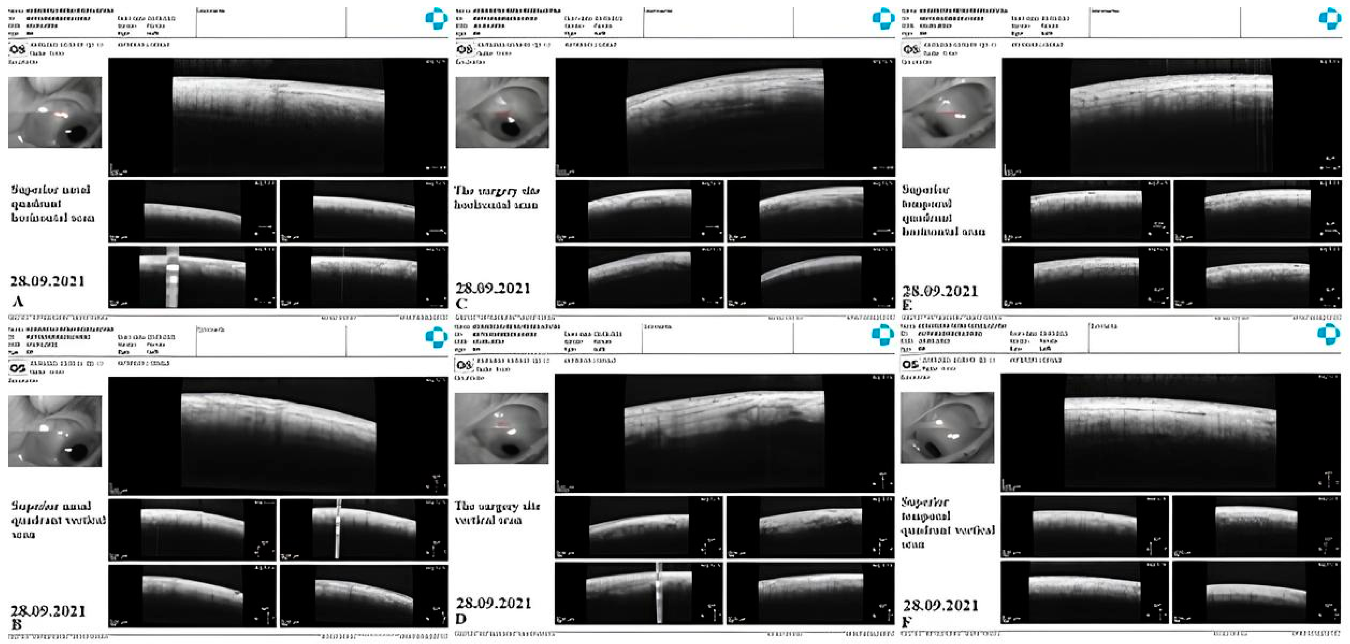 Vision 07 00059 g024