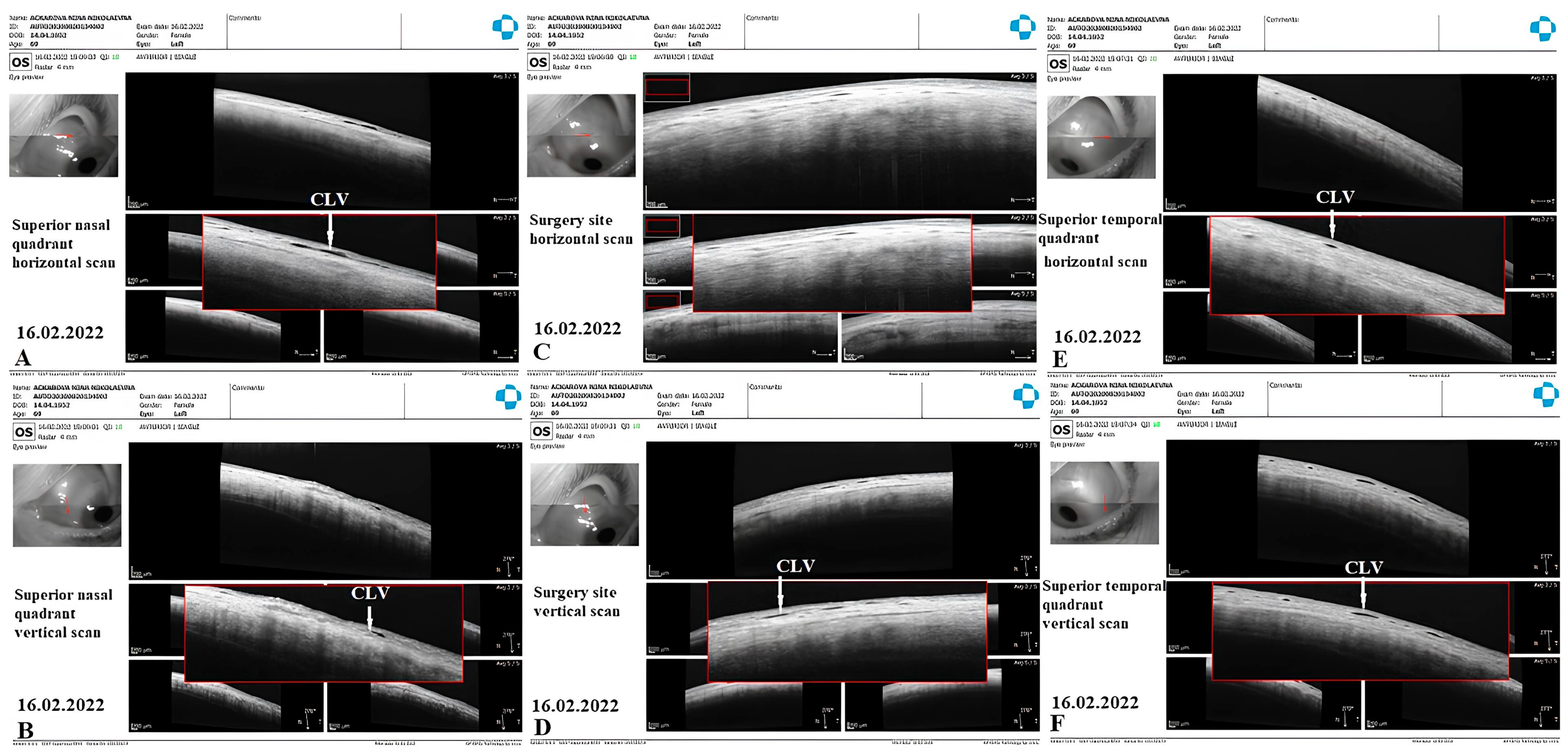 Vision 07 00059 g025