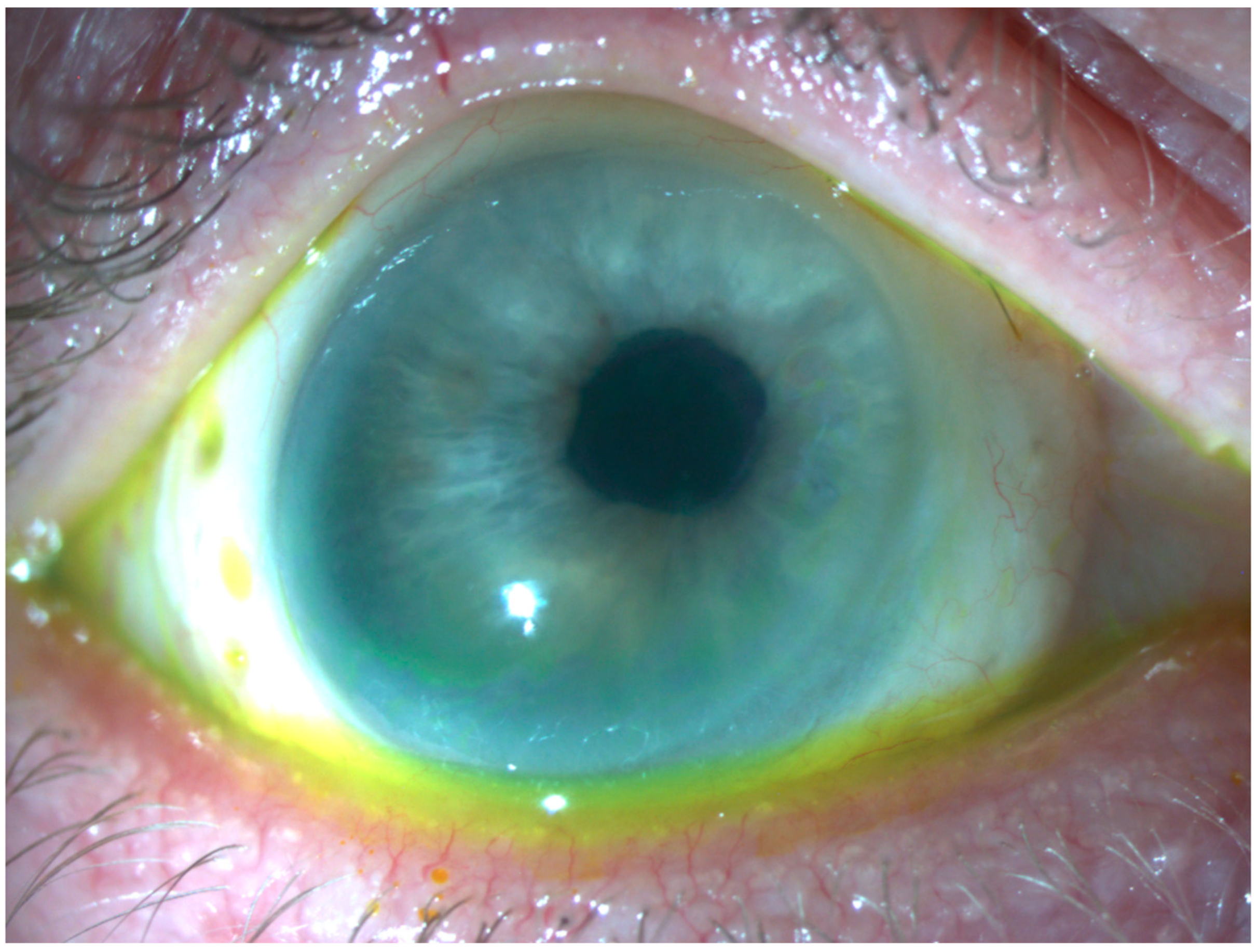 Vision 07 00062 g003