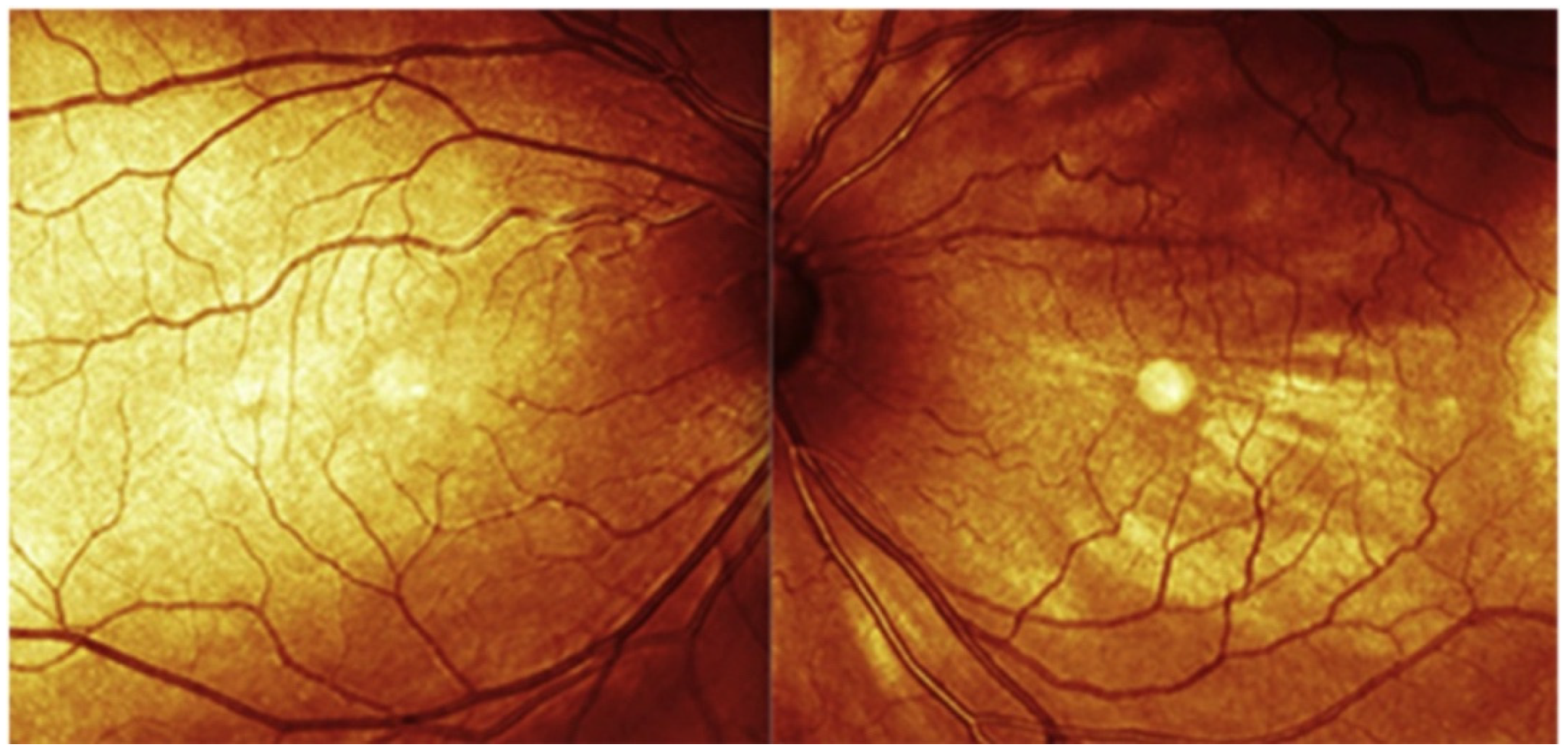 Vision 07 00064 g002