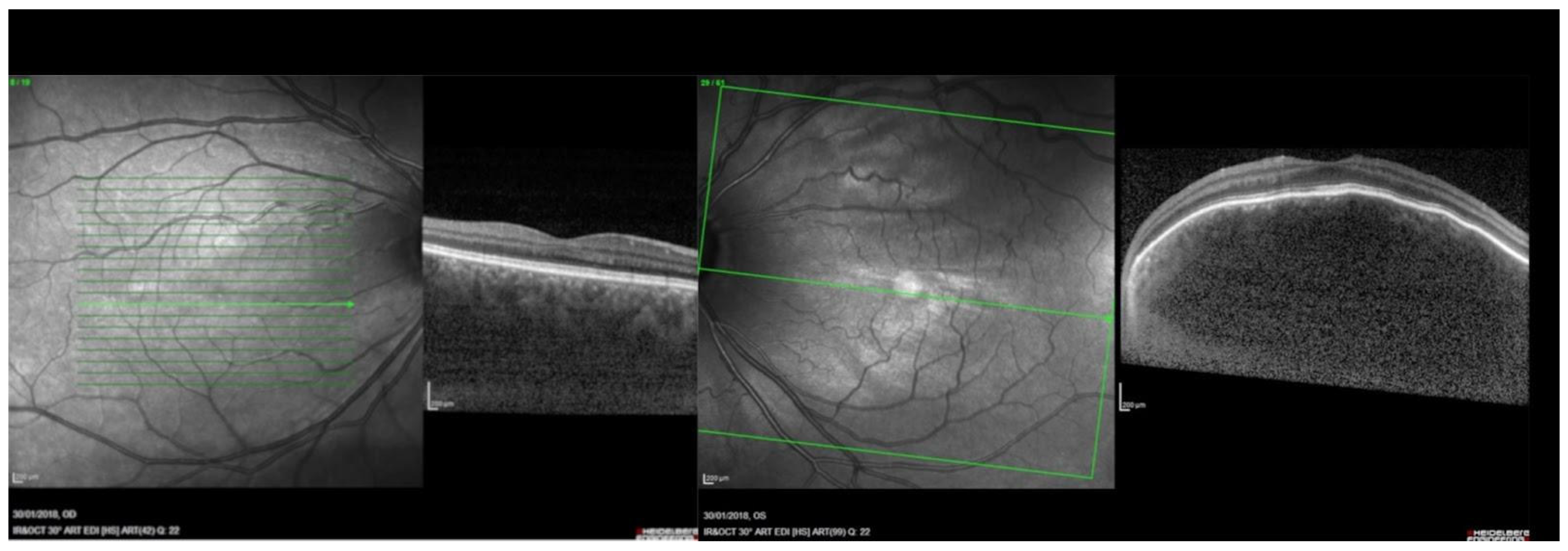 Vision 07 00064 g003