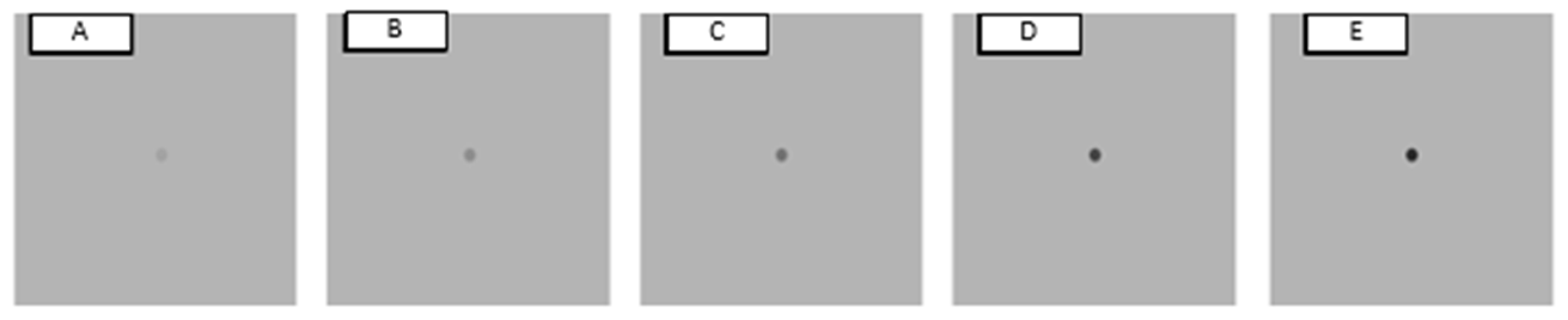 Vision 07 00068 g002 Vision 07 00068 g002