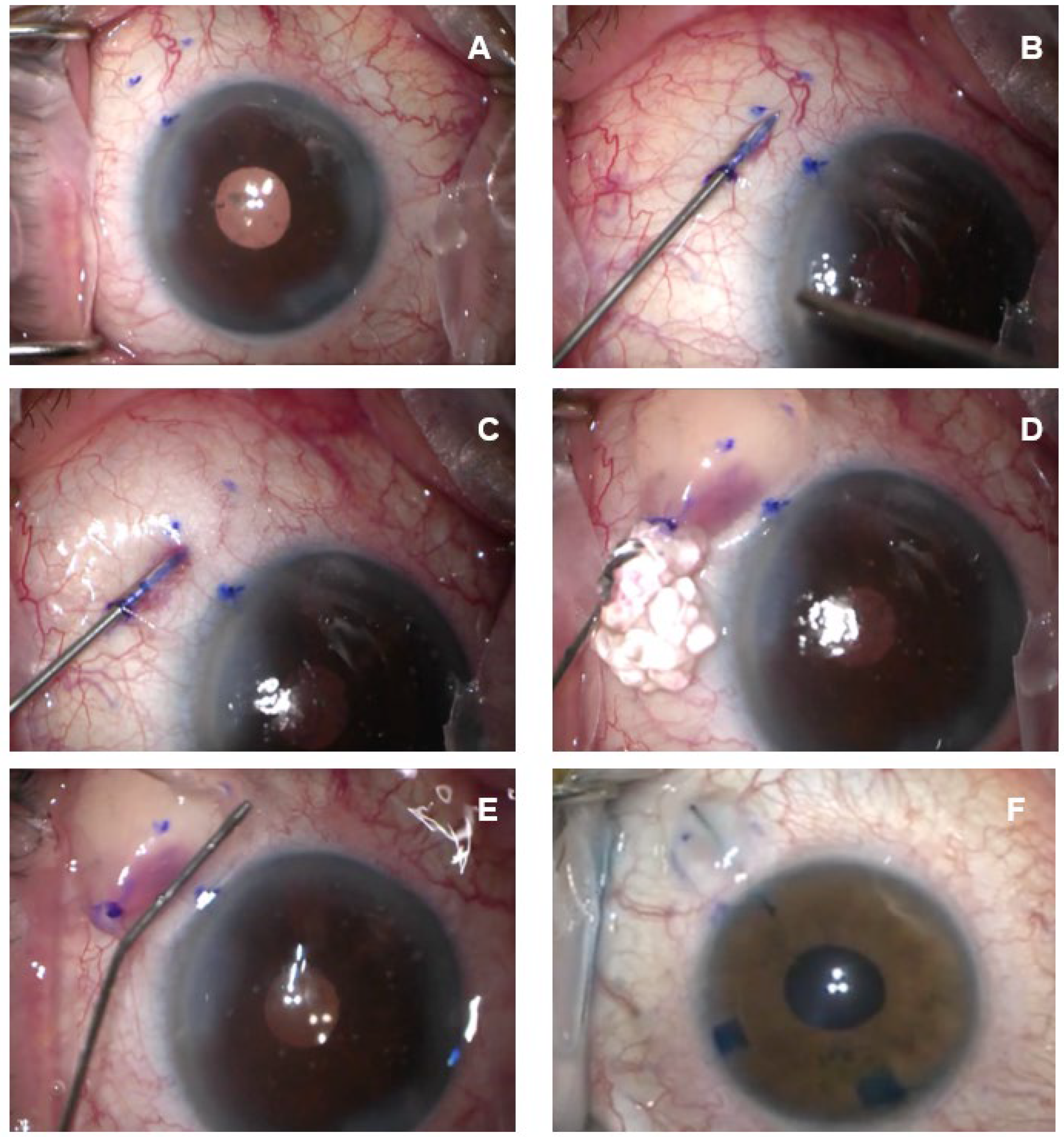 Vision 07 00071 g001