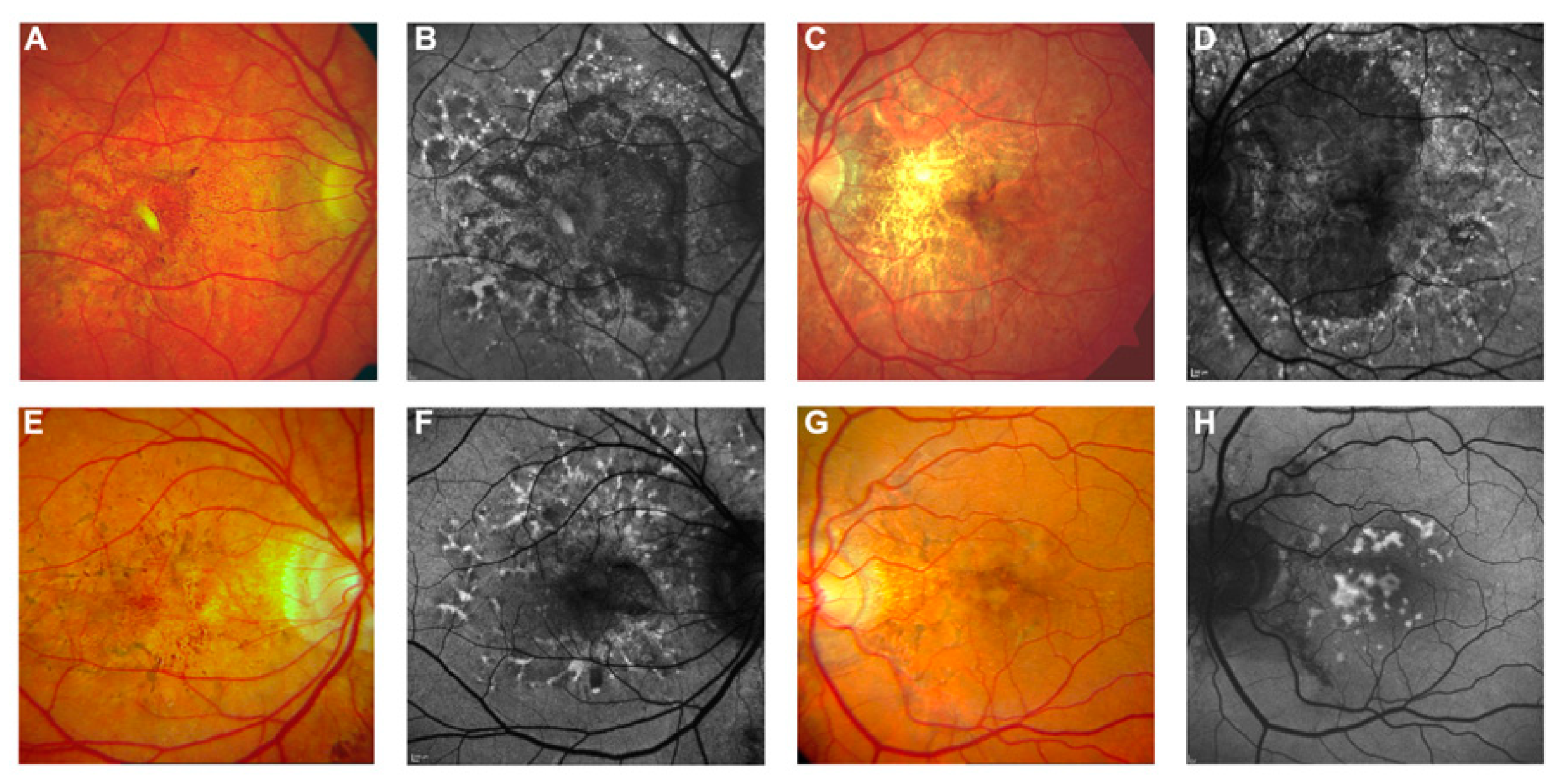 Vision 08 00010 g002
