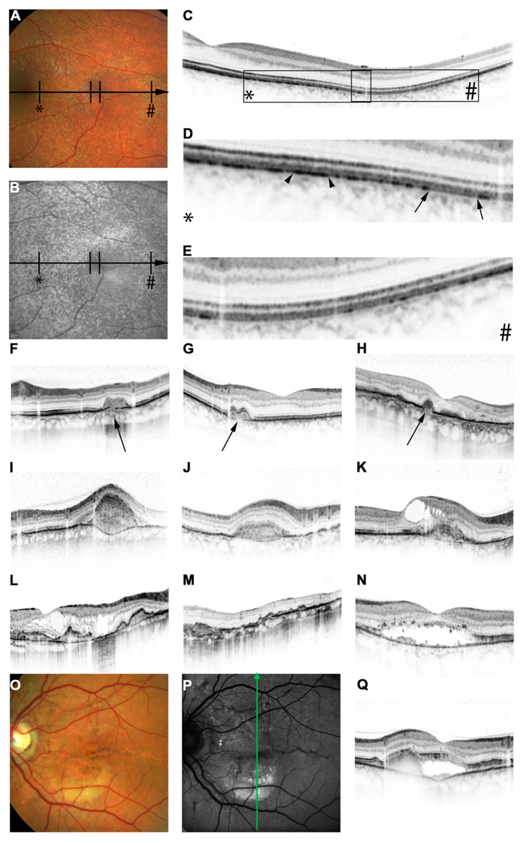 Vision 08 00010 g003