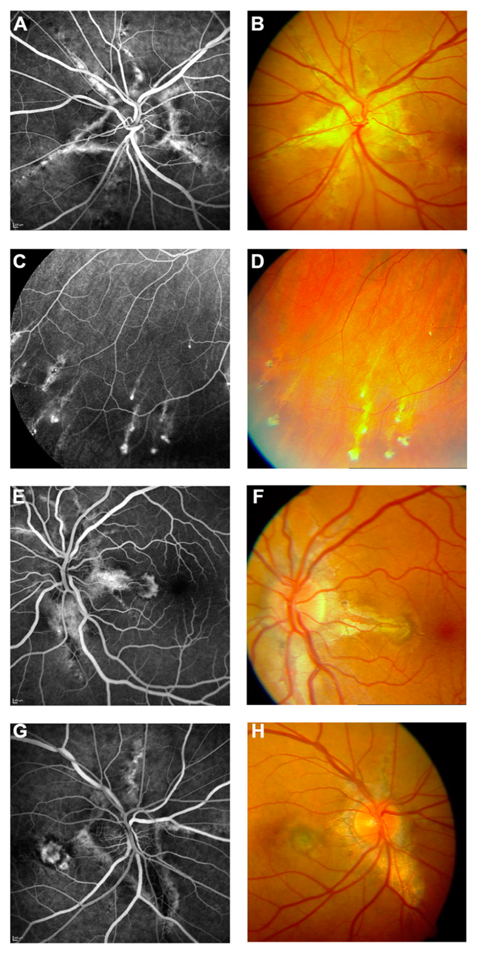 Vision 08 00010 g005