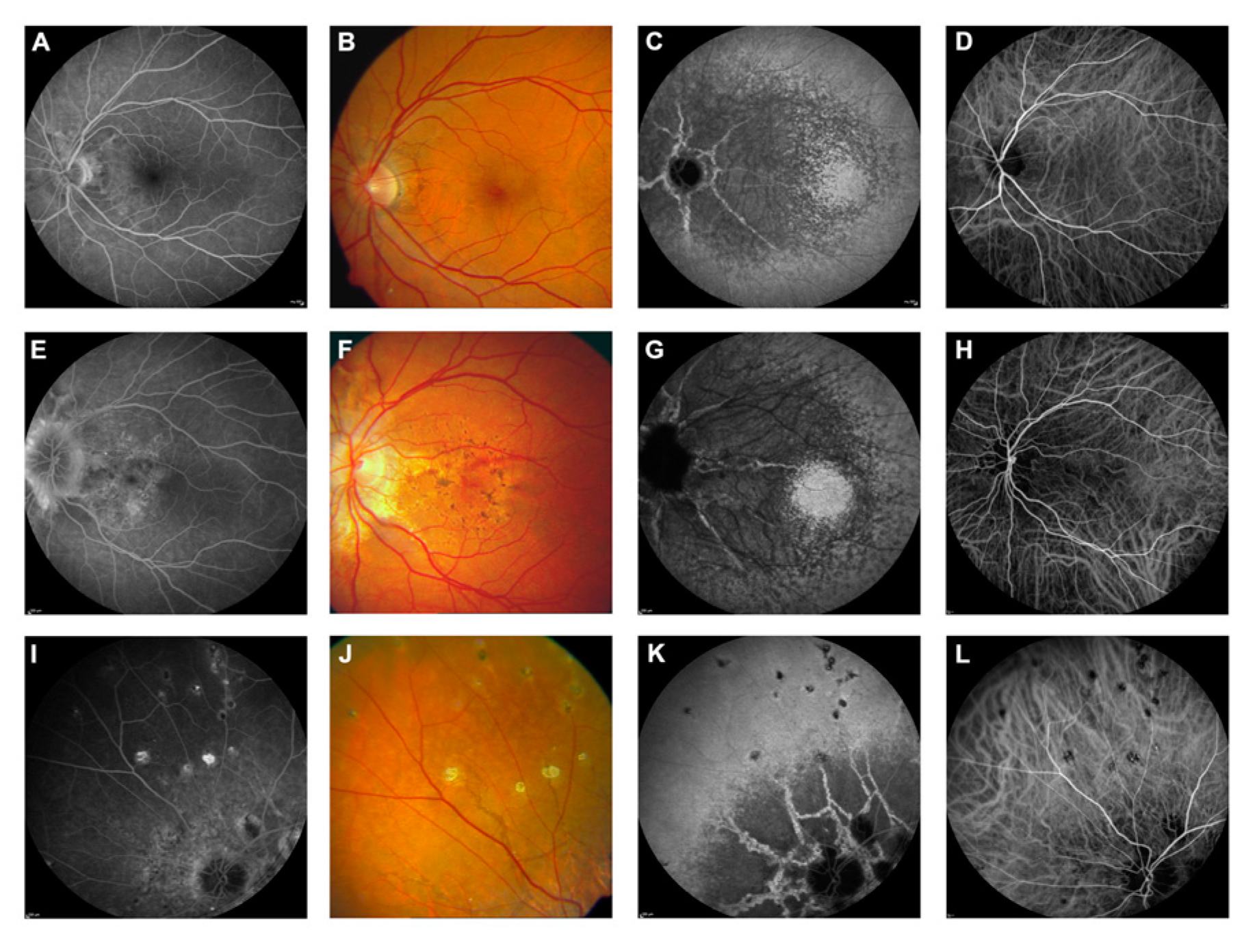 Vision 08 00010 g006