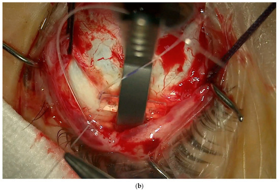 Vision 08 00042 g008b