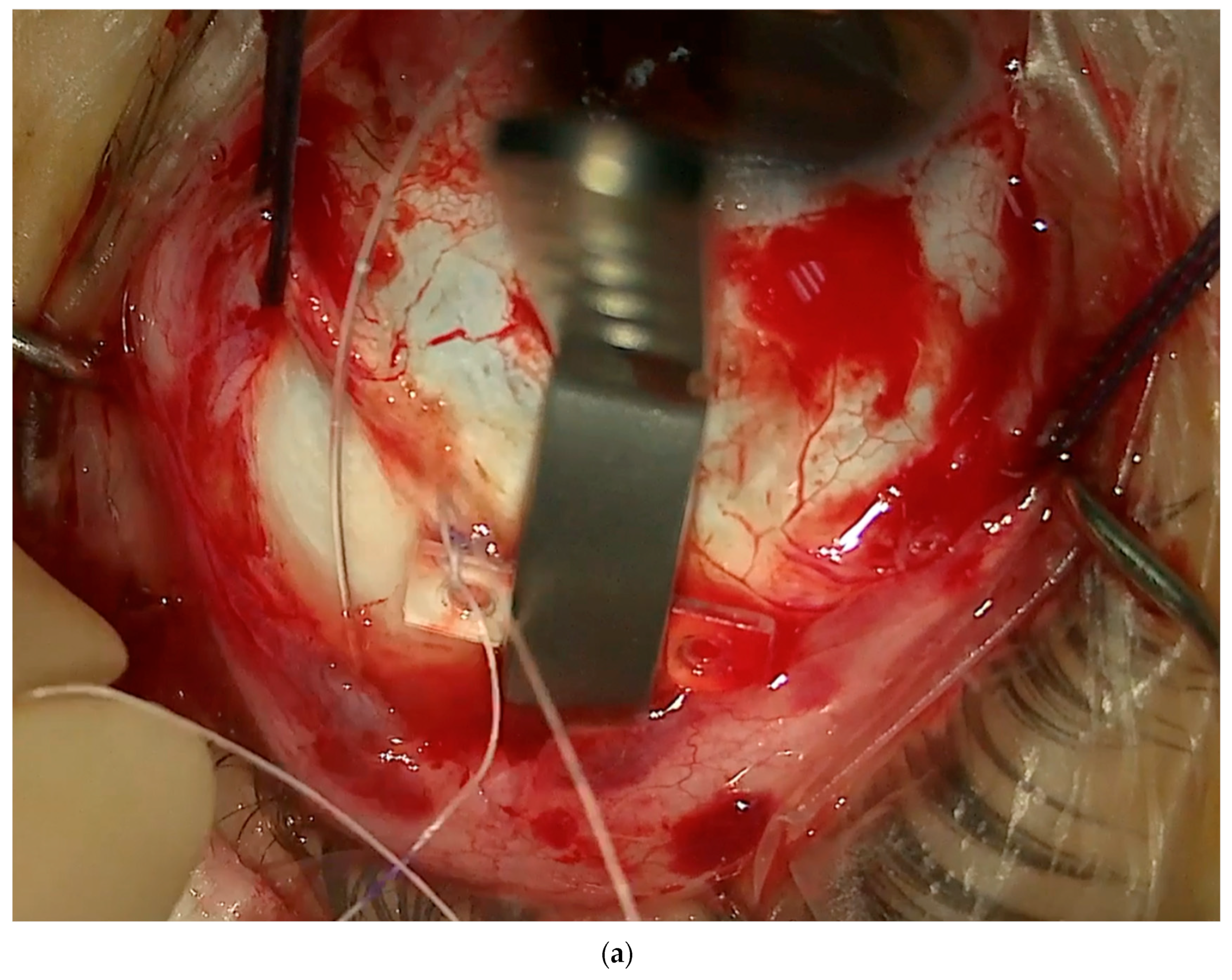 Vision 08 00042 g009a