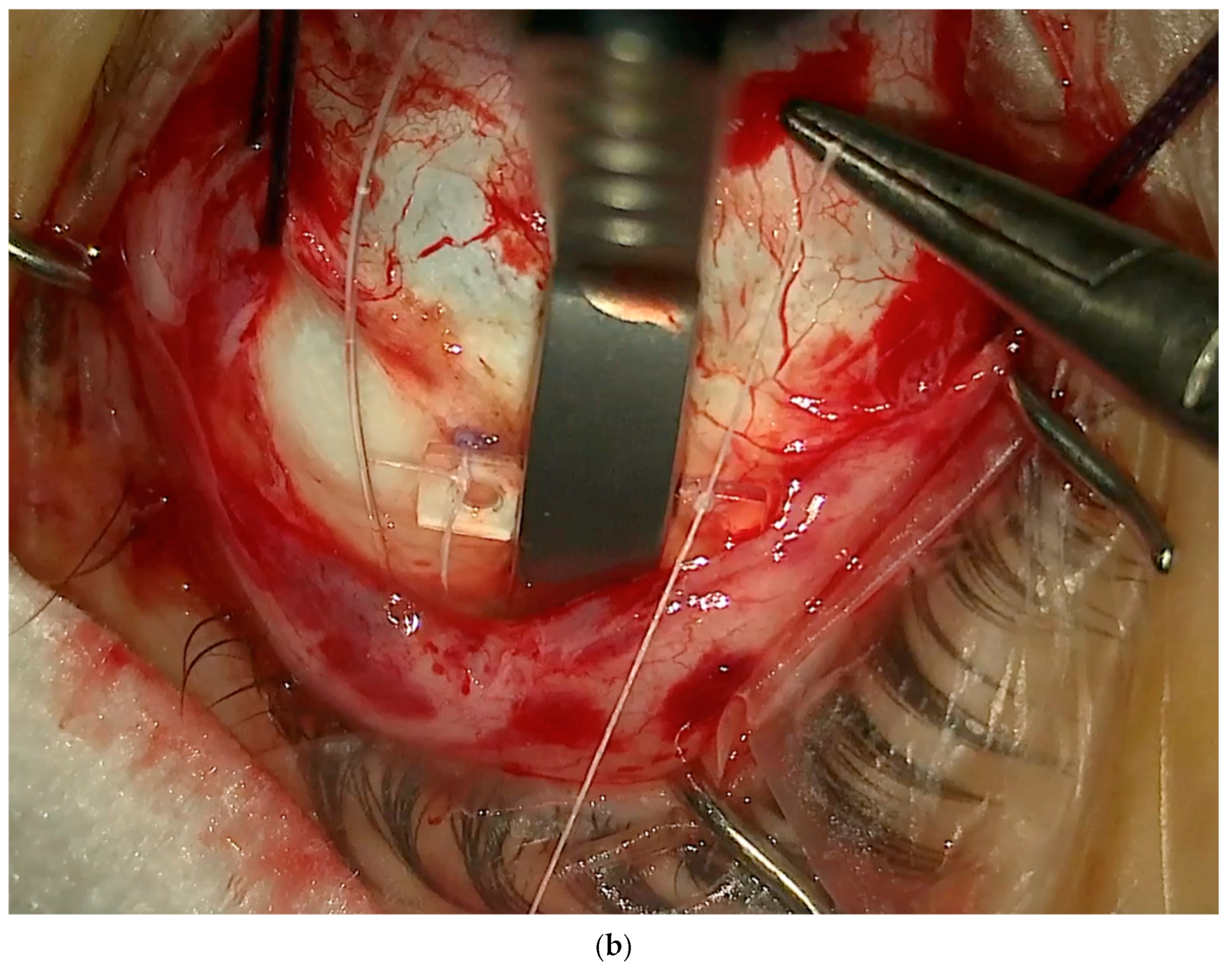 Vision 08 00042 g009b