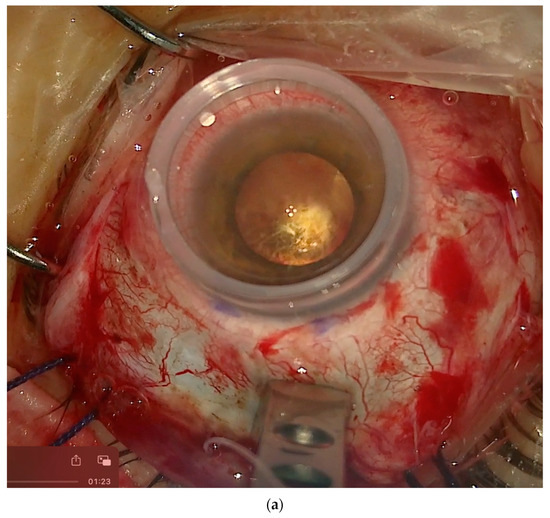 Vision 08 00042 g010a