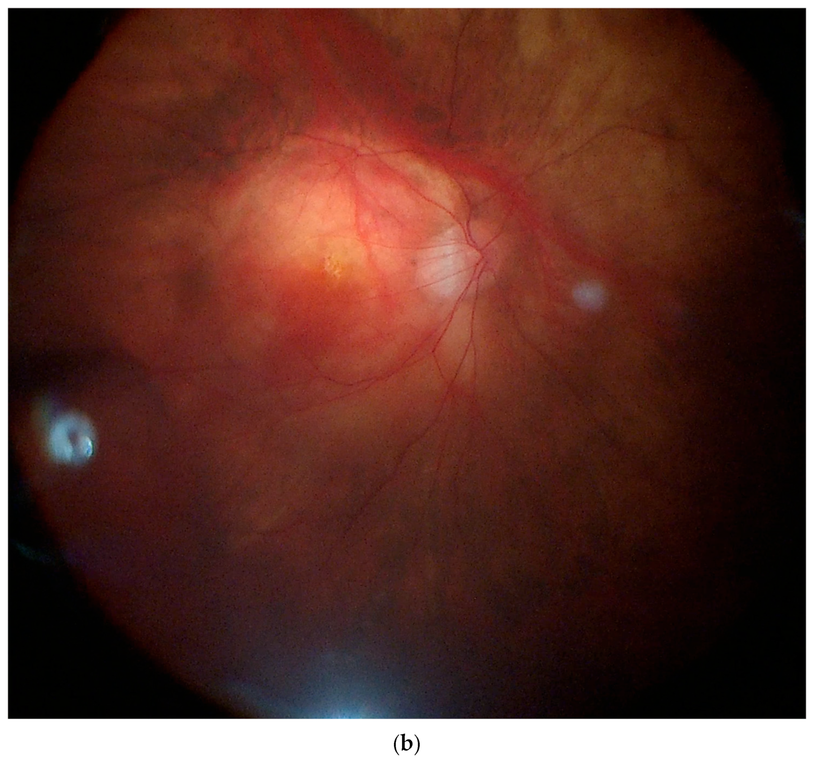 Vision 08 00042 g010b