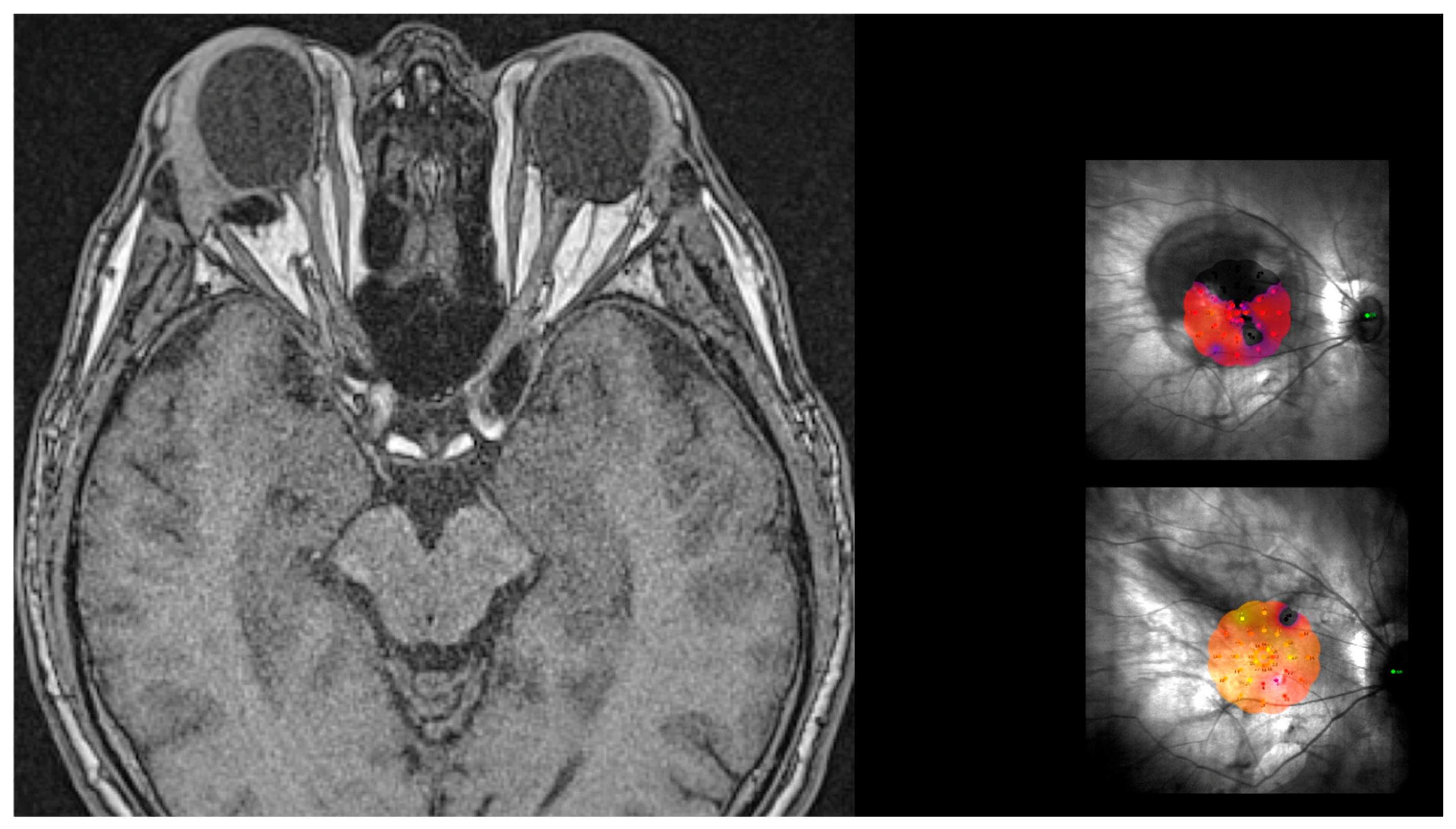 Vision 08 00042 g011