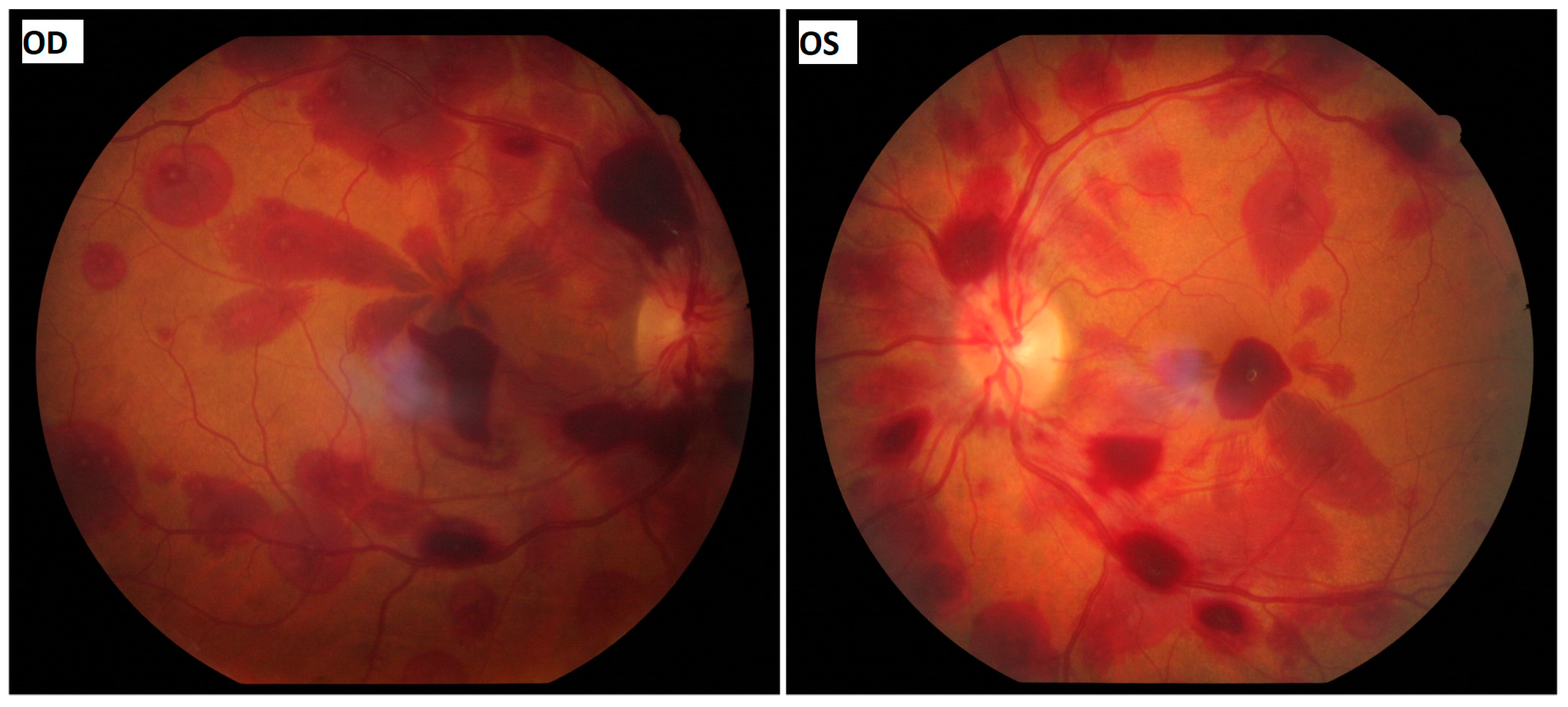 Vision 08 00061 g001 Vision 08 00061 g001