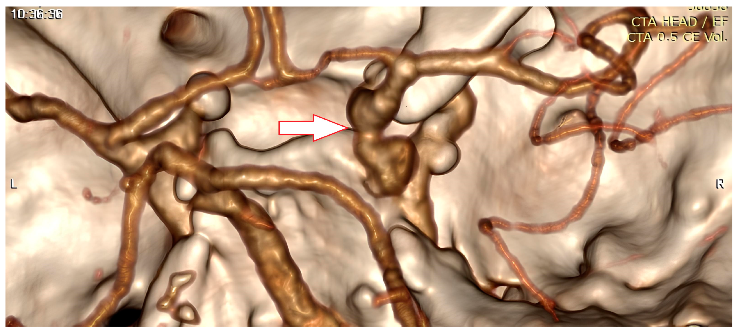 Vision 08 00061 g002 Vision 08 00061 g002