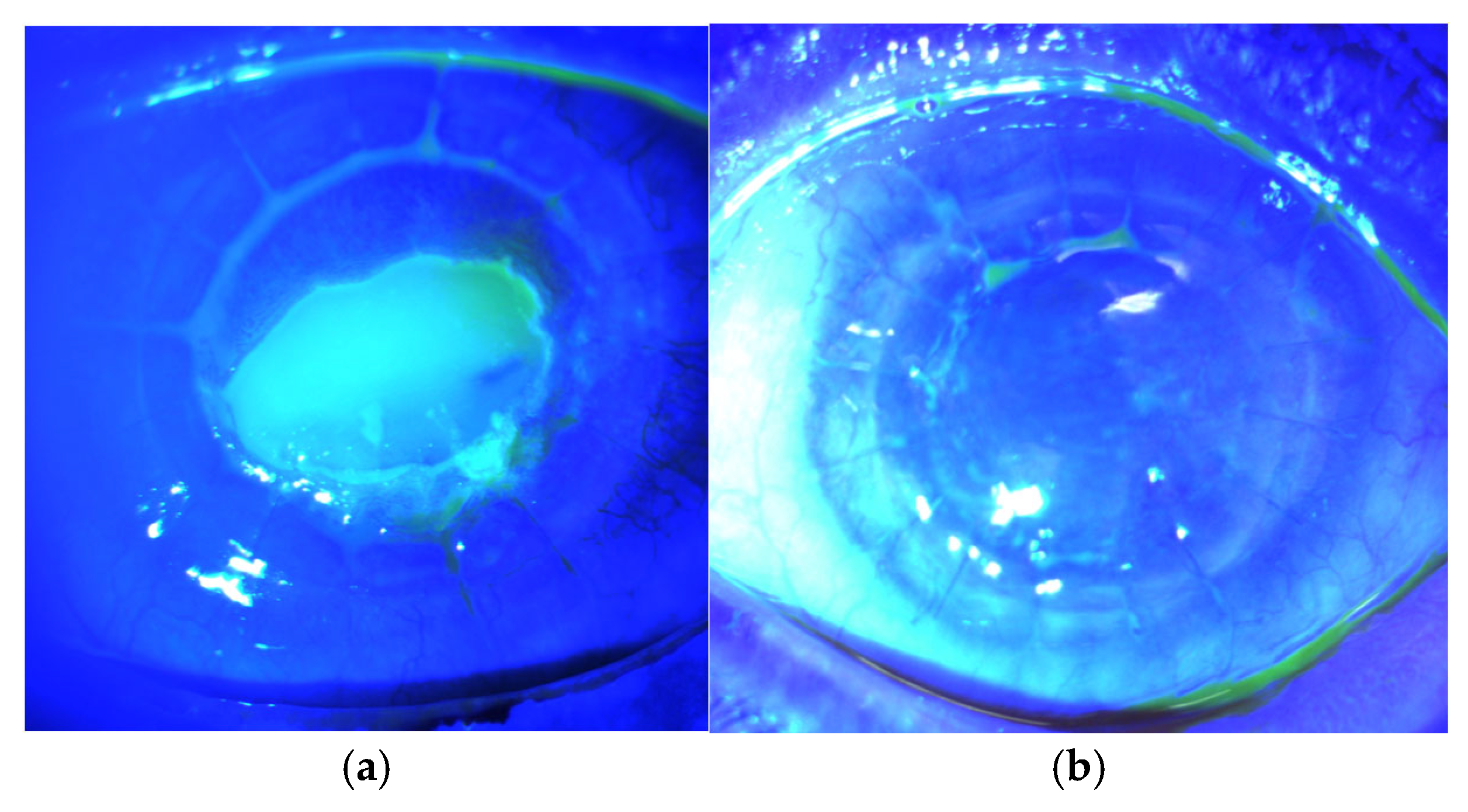 Vision 09 00026 g001