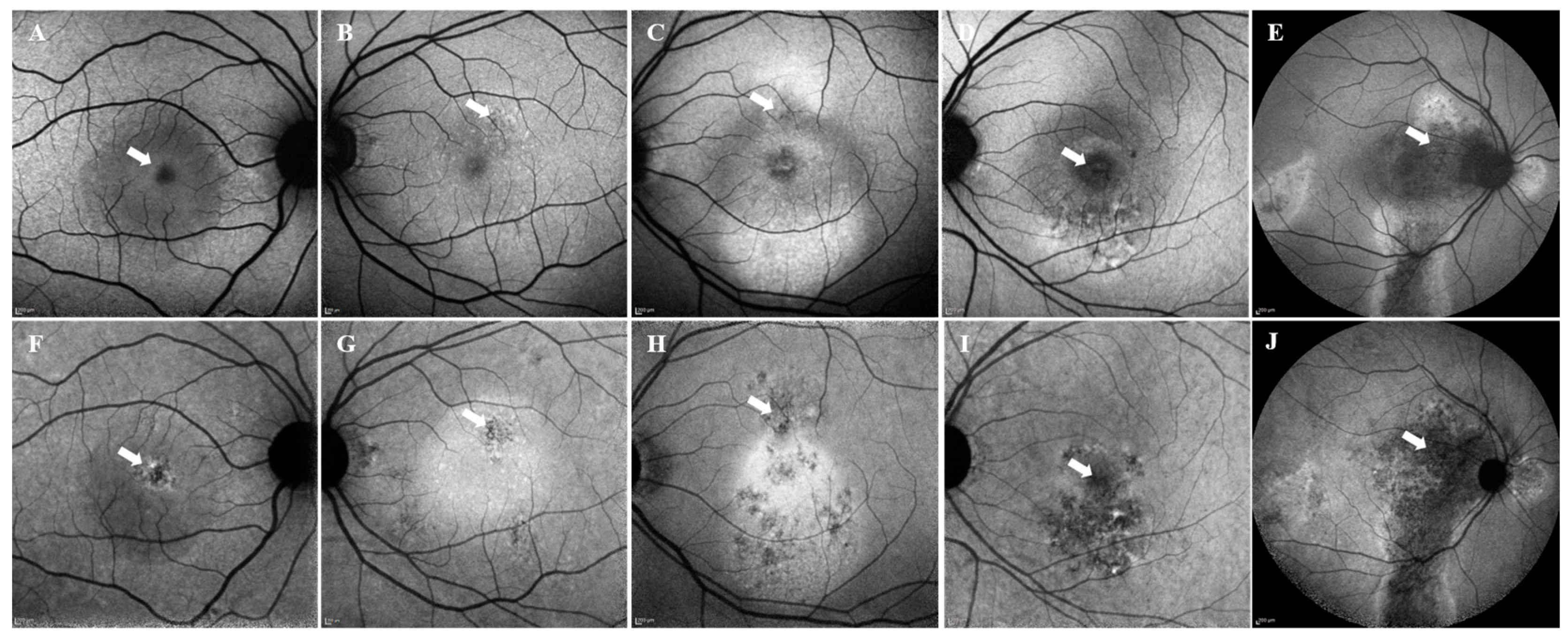 Vision 09 00038 g001