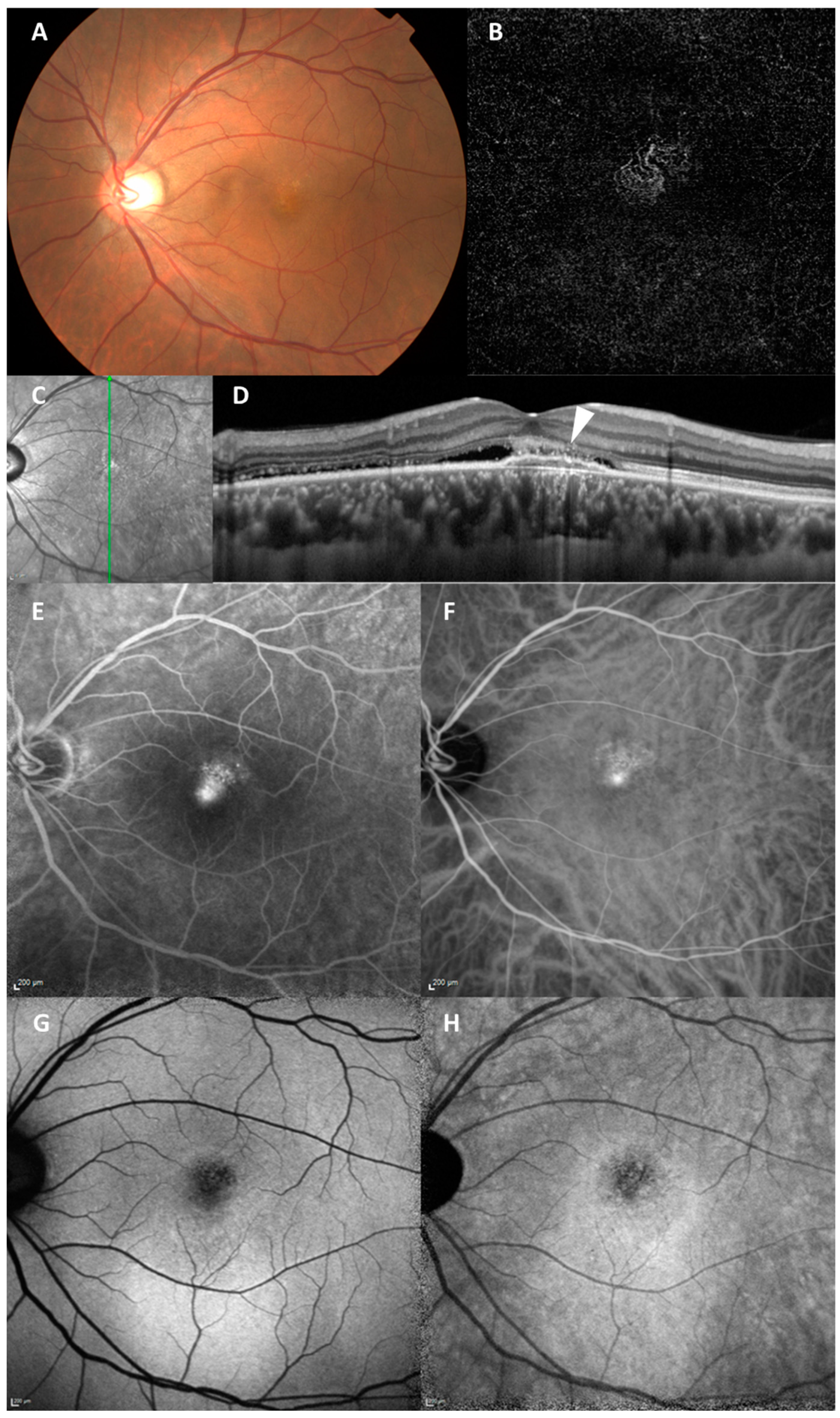 Vision 09 00038 g004