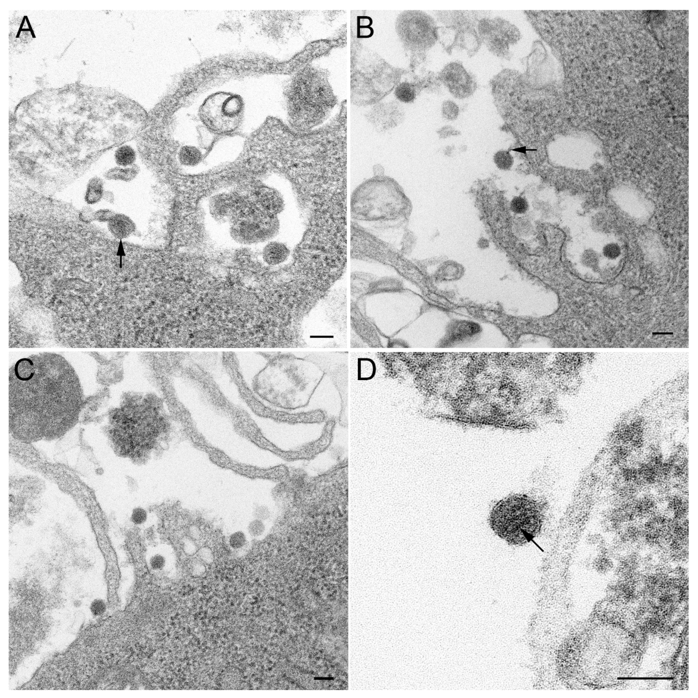 Zoonoticdis 05 00009 g002