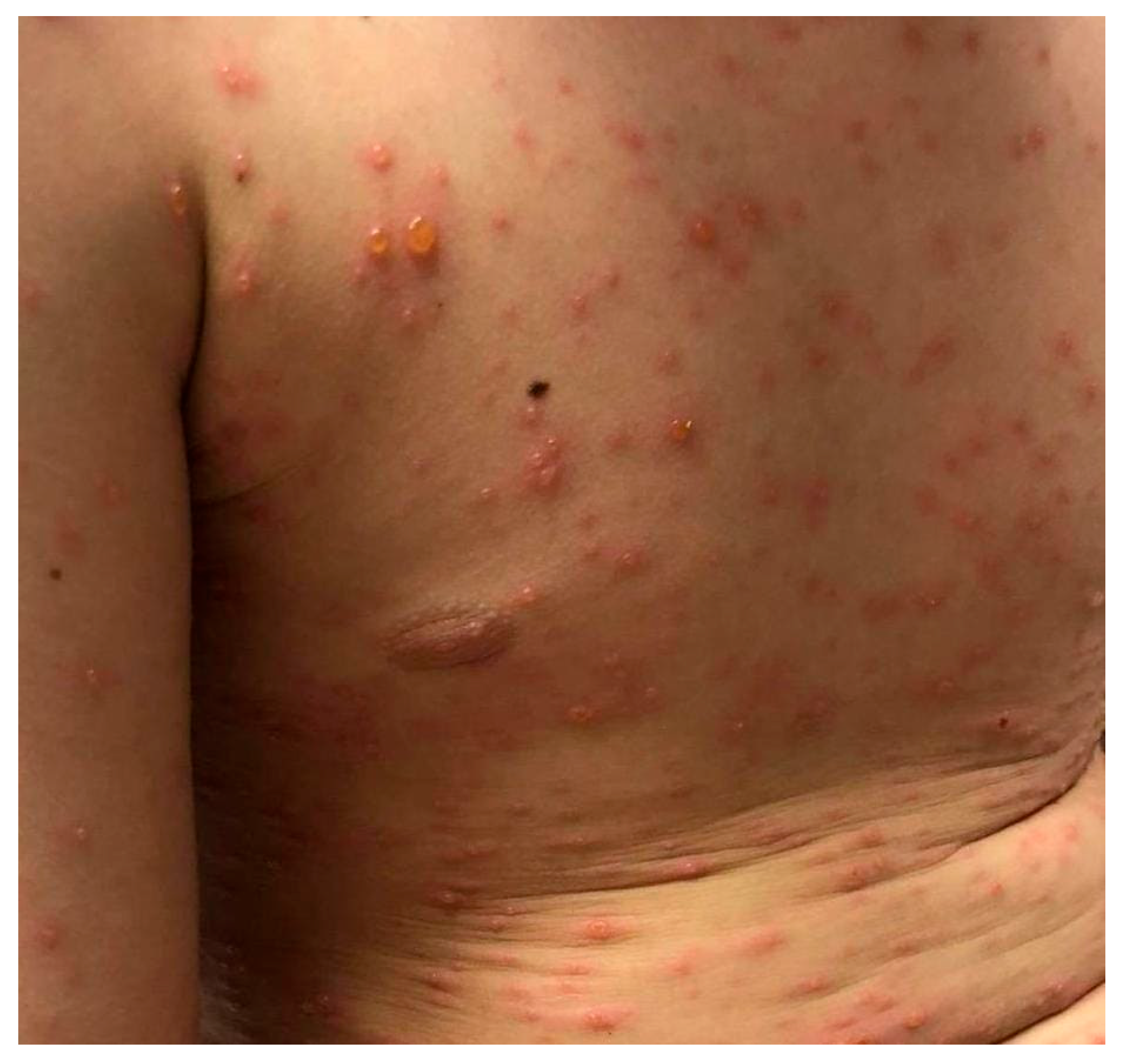 Zoonoticdis 05 00016 g003