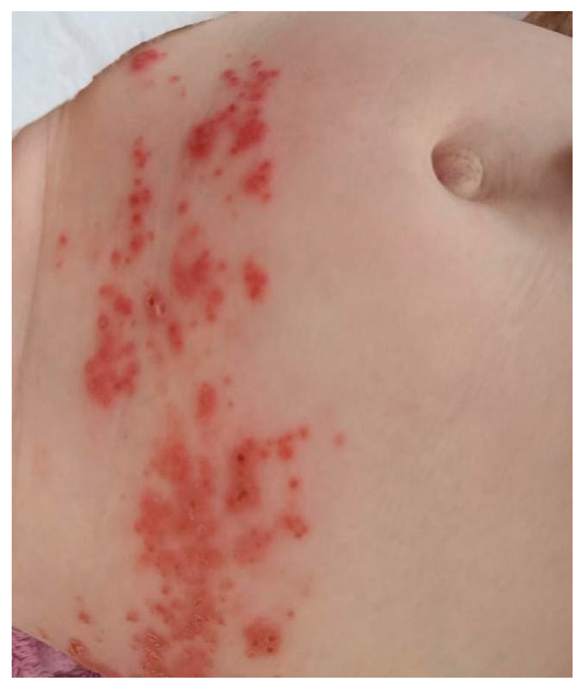 Zoonoticdis 05 00016 g004