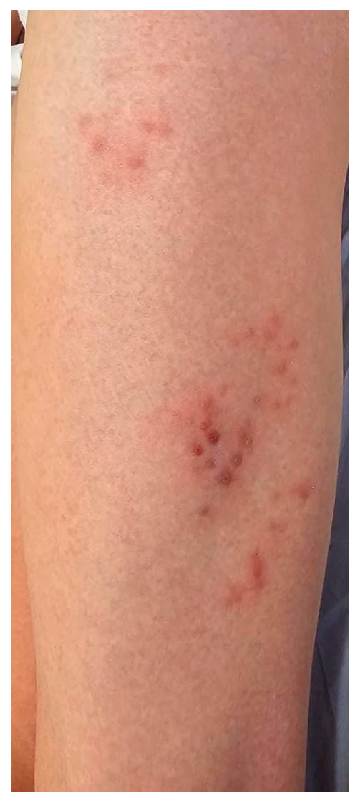 Zoonoticdis 05 00016 g005